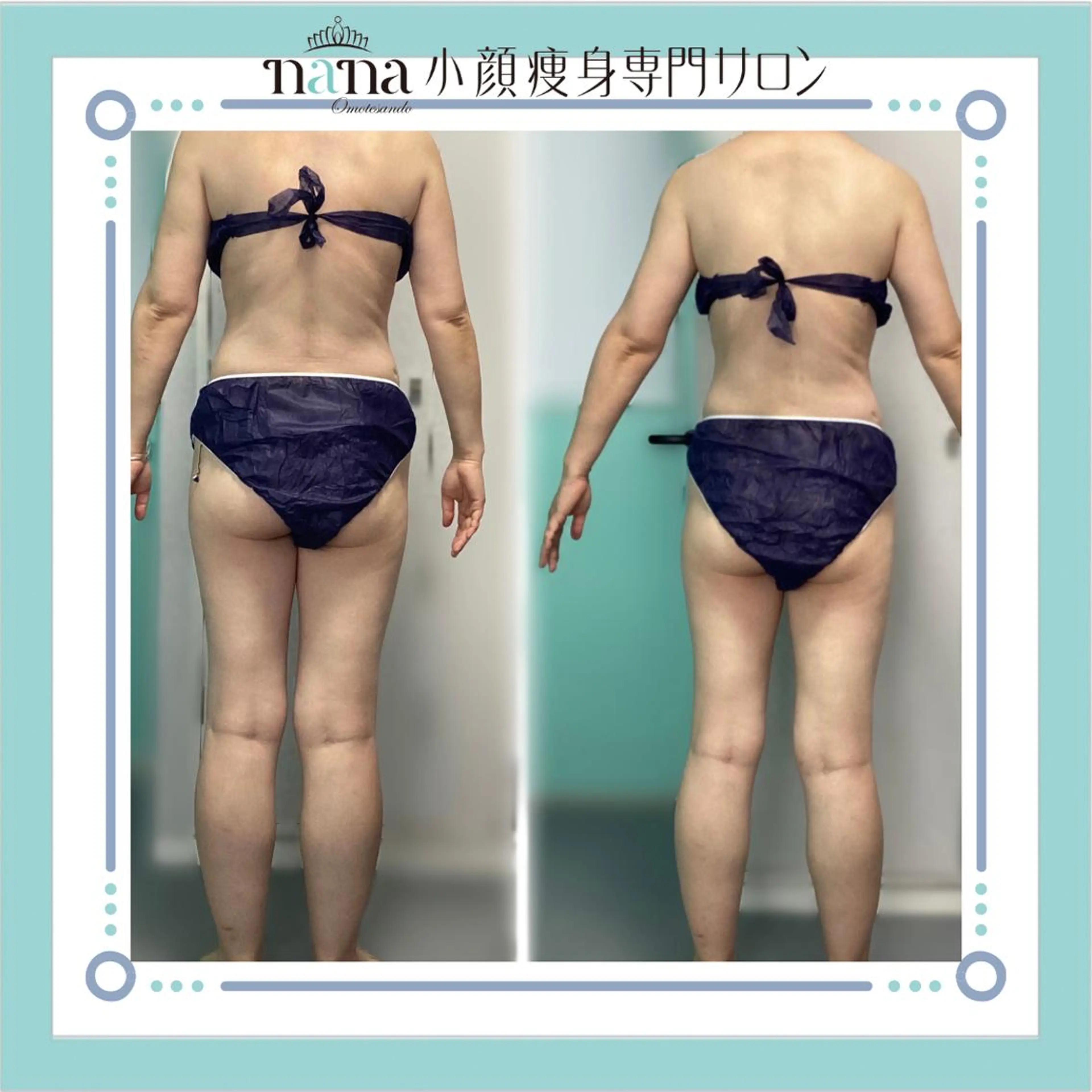 小顔痩身インディバ Nana表参道のエステ・リラクイメージ