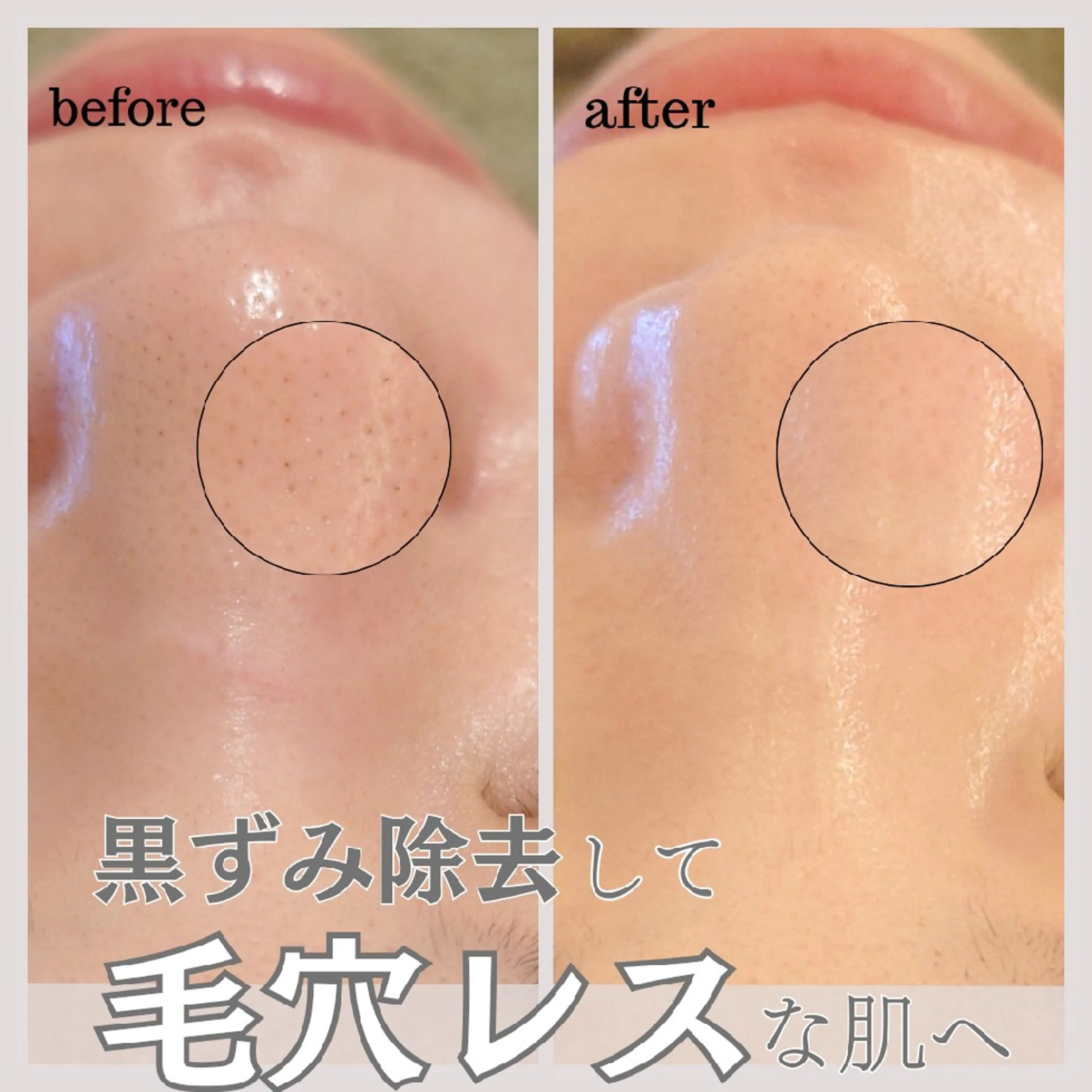 撮影モデル Ellebeauty relaxationのエステ・リラクイメージ