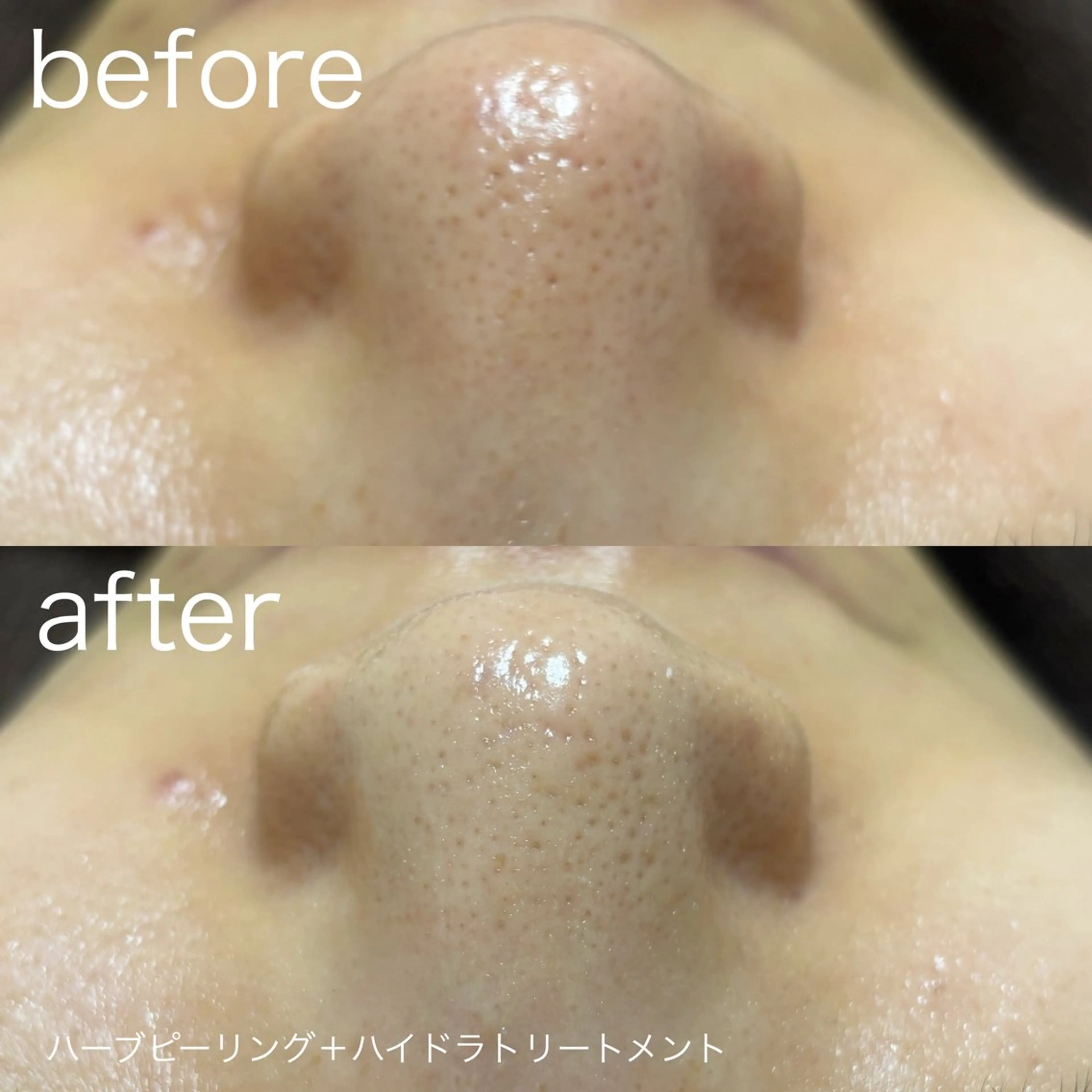 その他 lulularico Yuのエステ・リラクイメージ