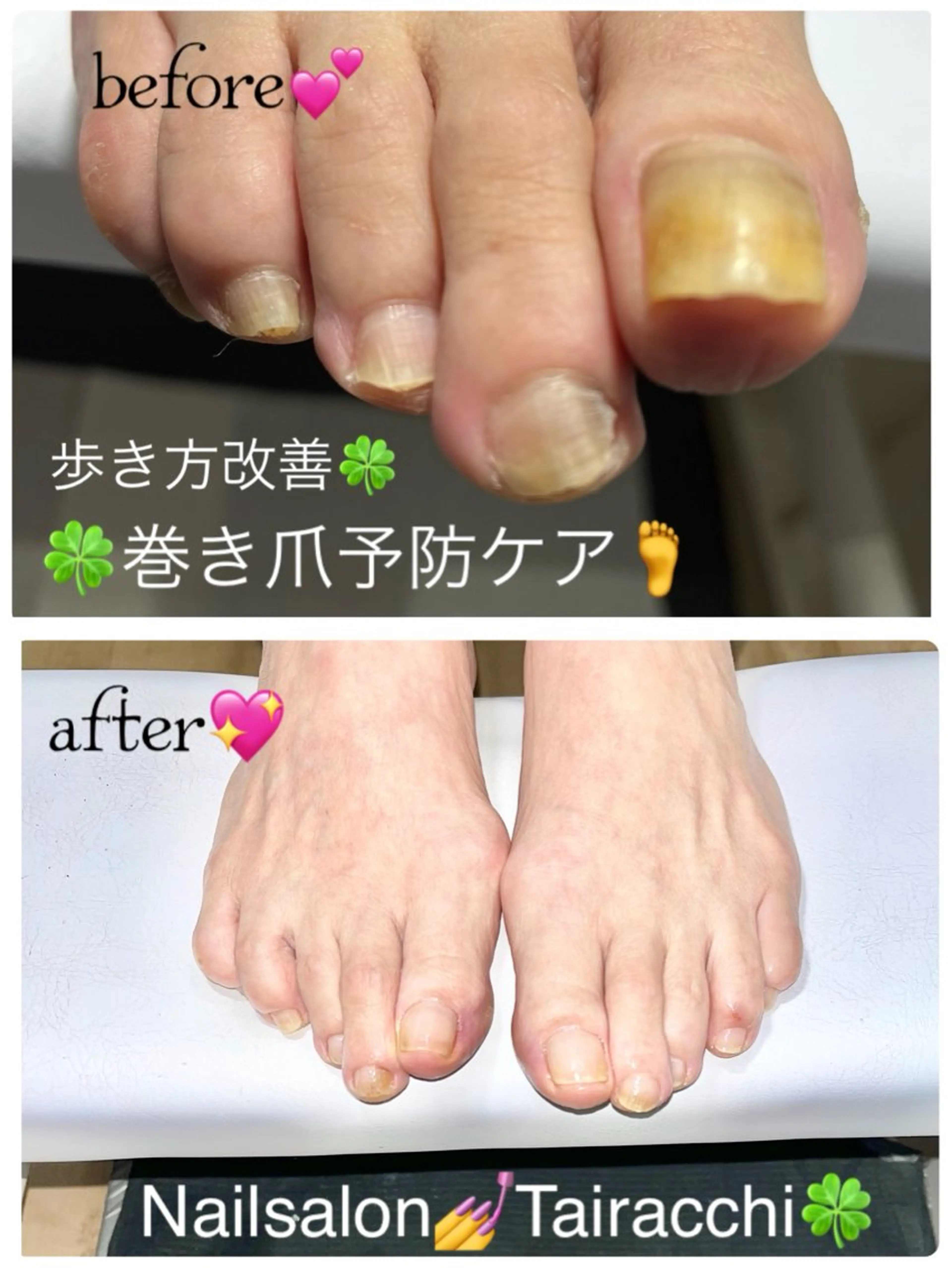 ネイル フットネイル フットネイル Tairacchi ﾀｲﾗｯﾁのネイルデザイン
