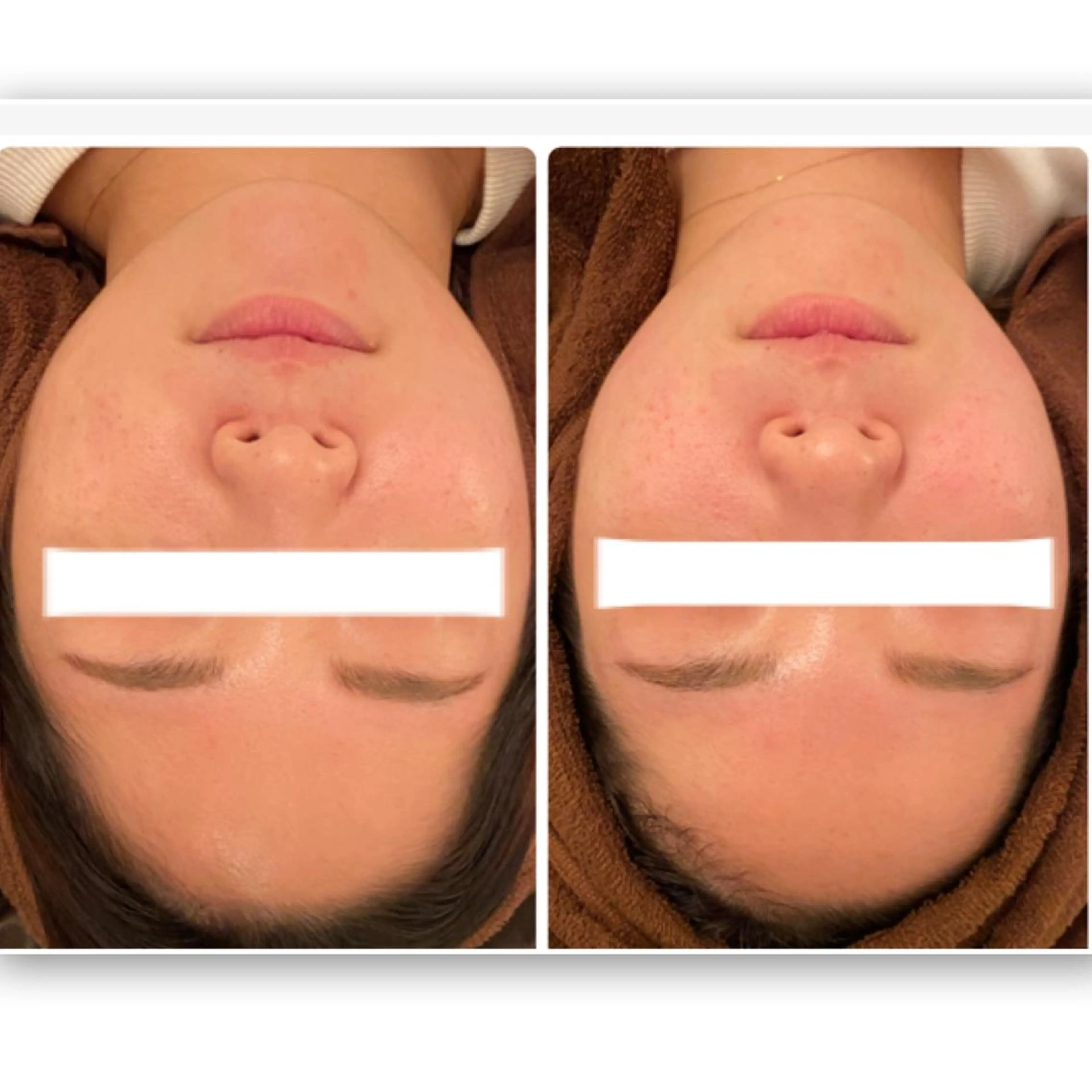 FLEUR大阪・整体 ・ハイフ・痩身・小顔のエステ・リラクイメージ