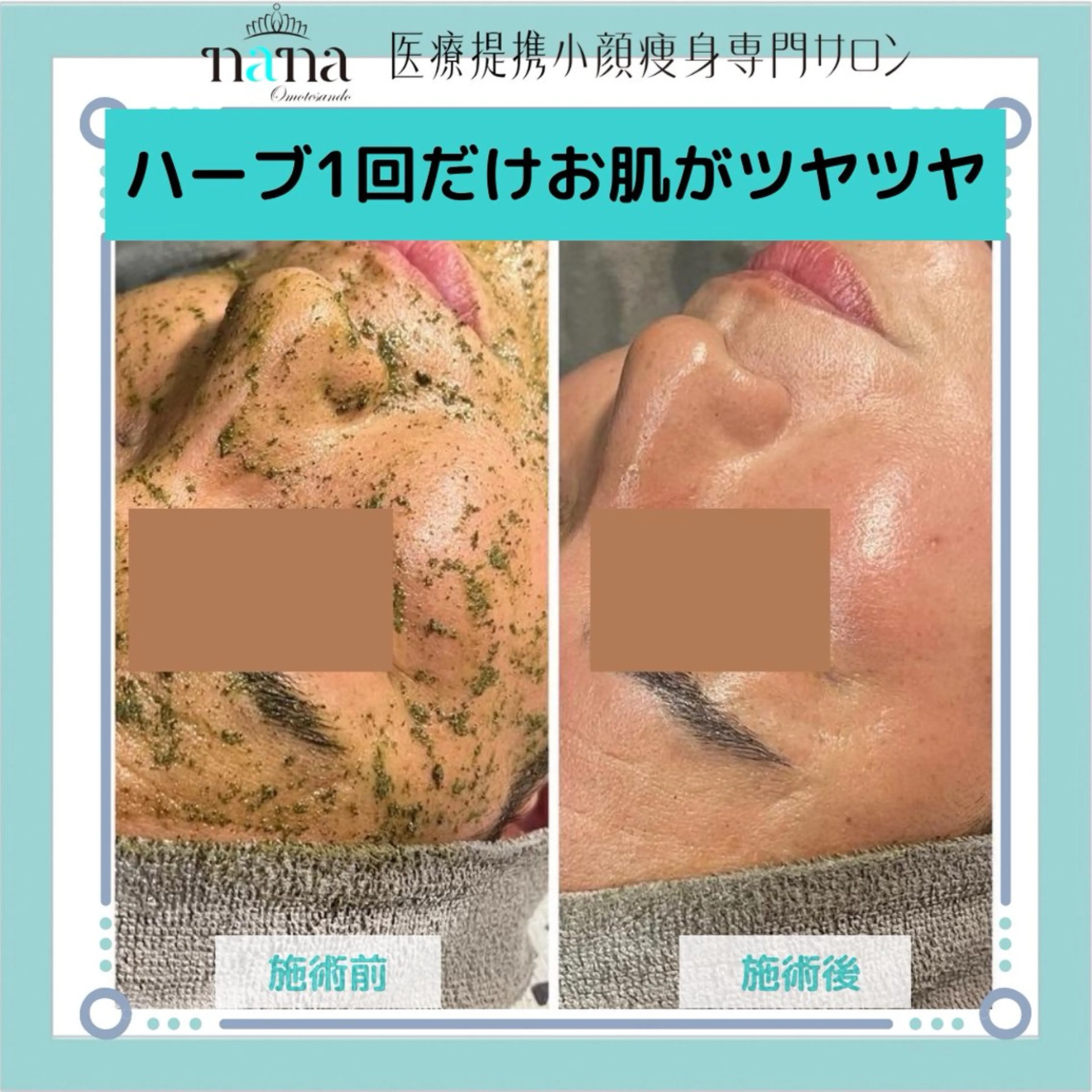 メンズ エステ リラク 小顔痩身インディバ Nana表参道のエステ・リラクイメージ