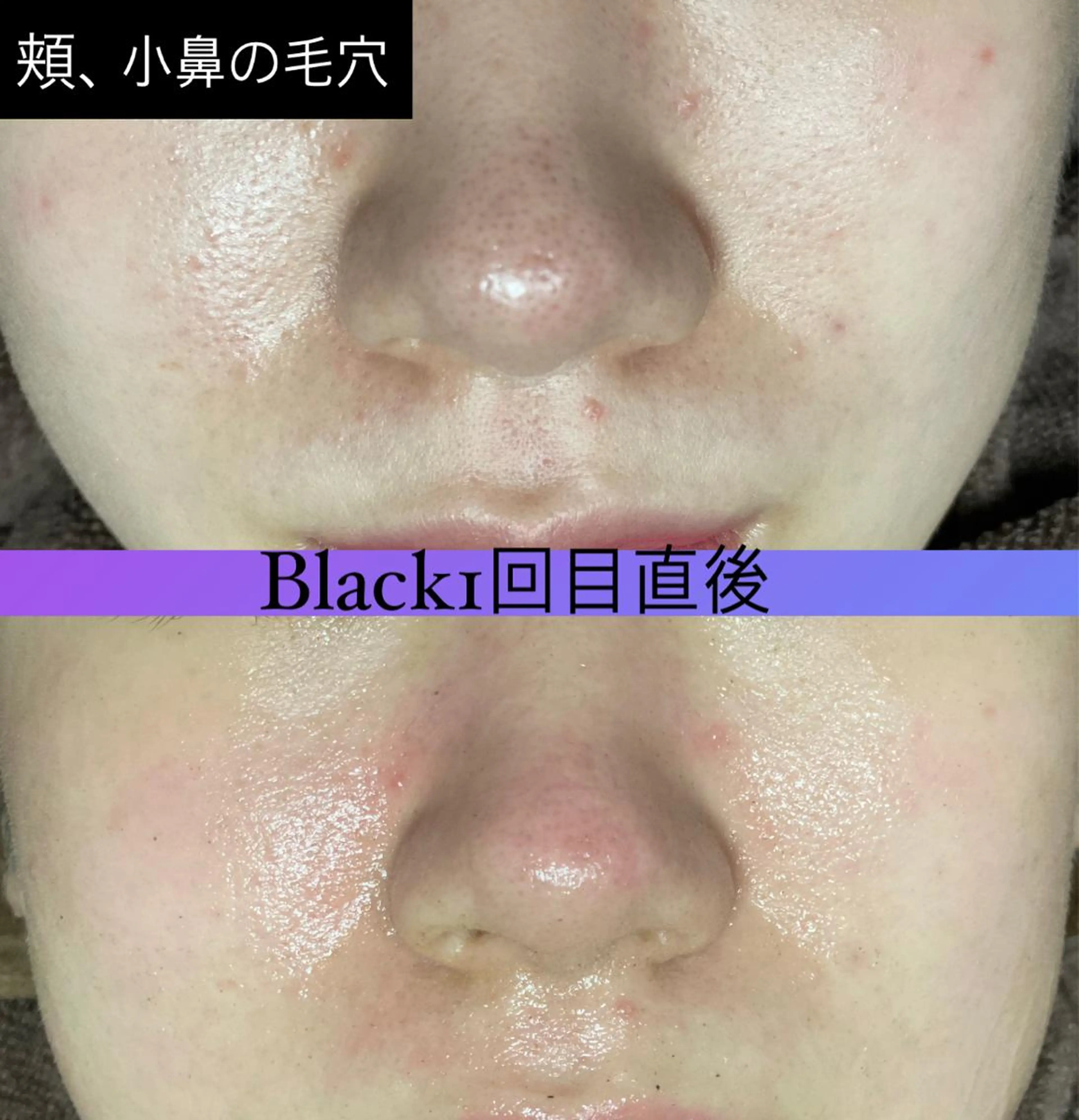 エステ 横浜private salonMOMOのエステ・リラクイメージ