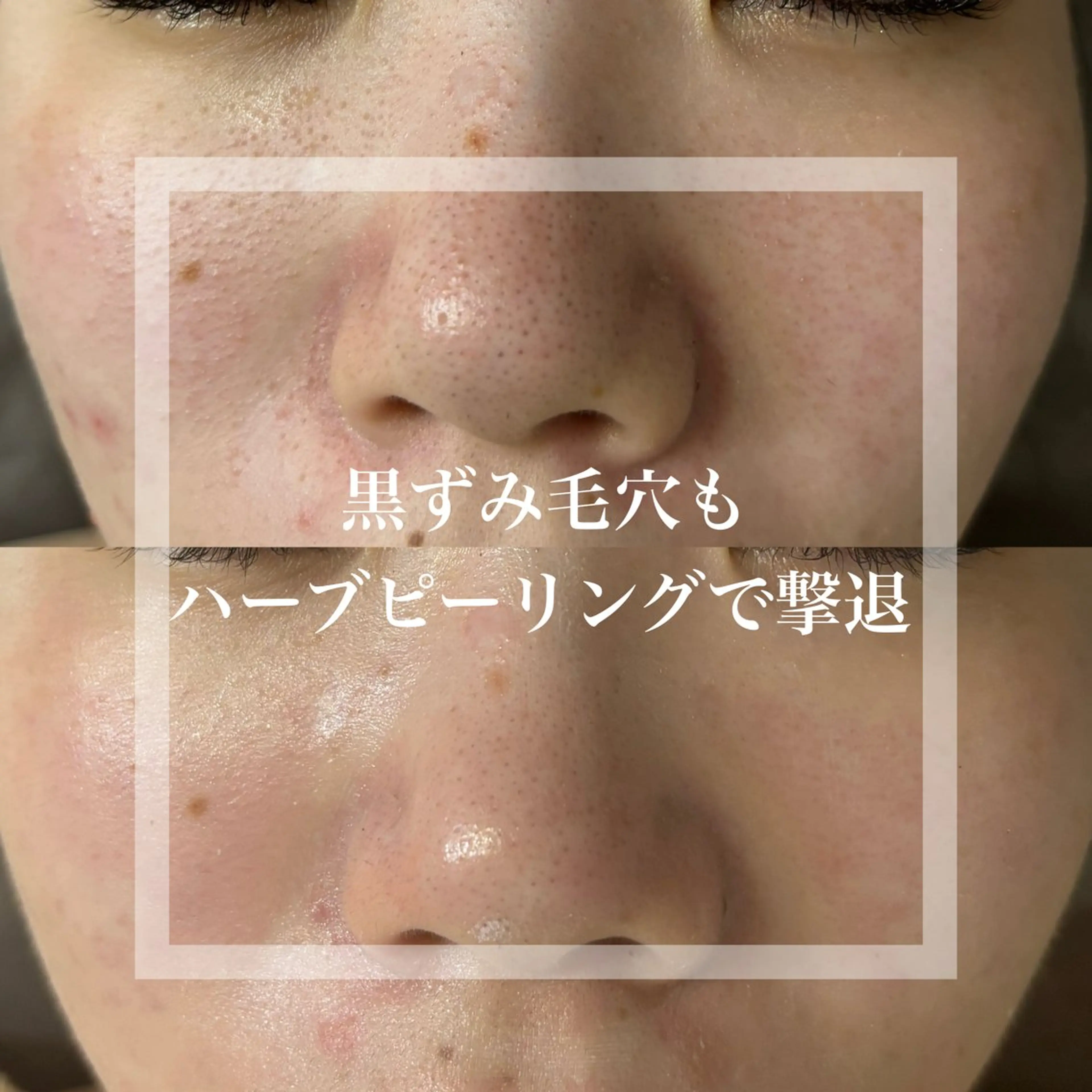 エステ WHITE AQUA 北千住店のエステ・リラクイメージ