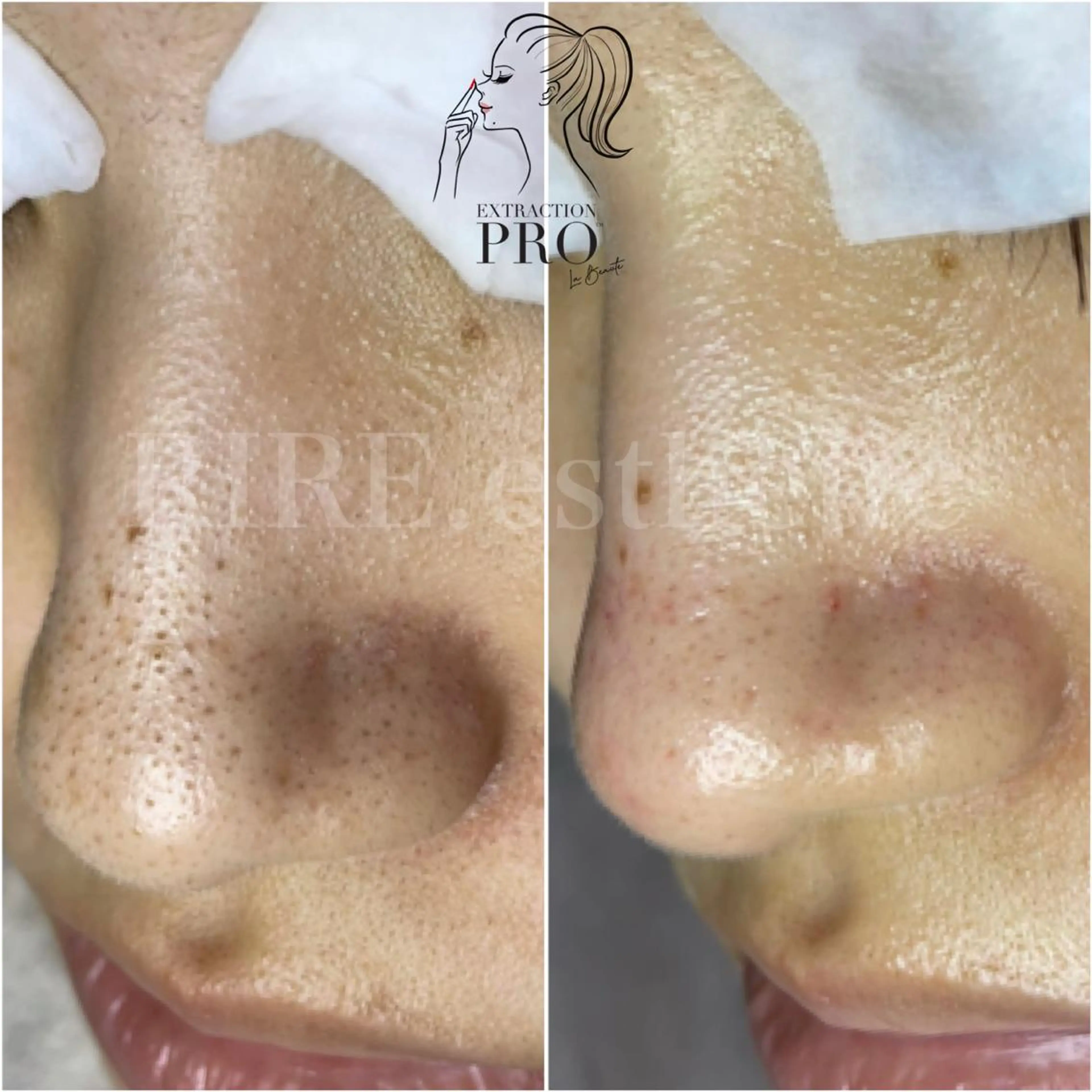 毛穴肌育専門店 リールのエステ・リラクイメージ