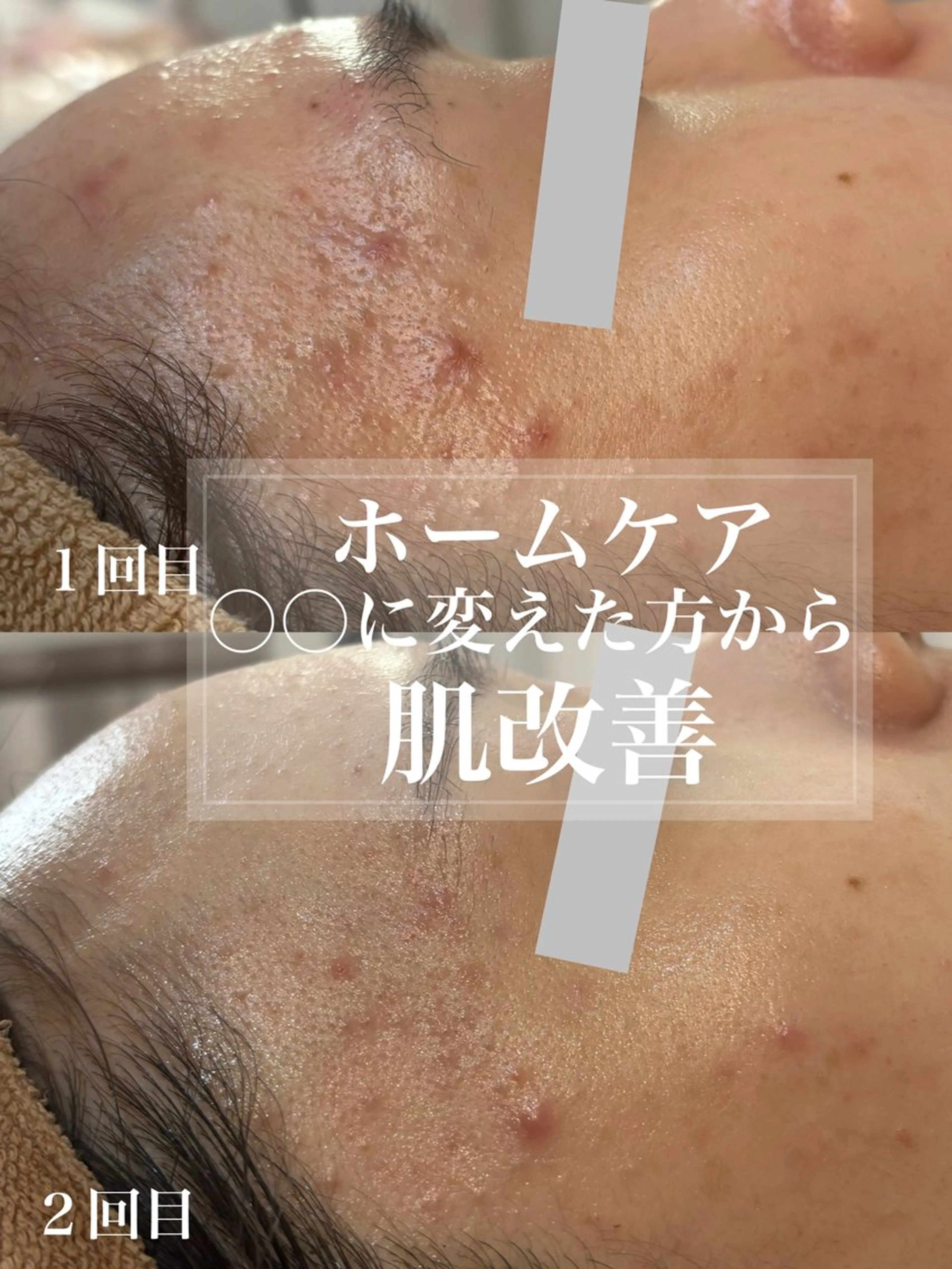 エステ WHITE AQUA 北千住店のエステ・リラクイメージ