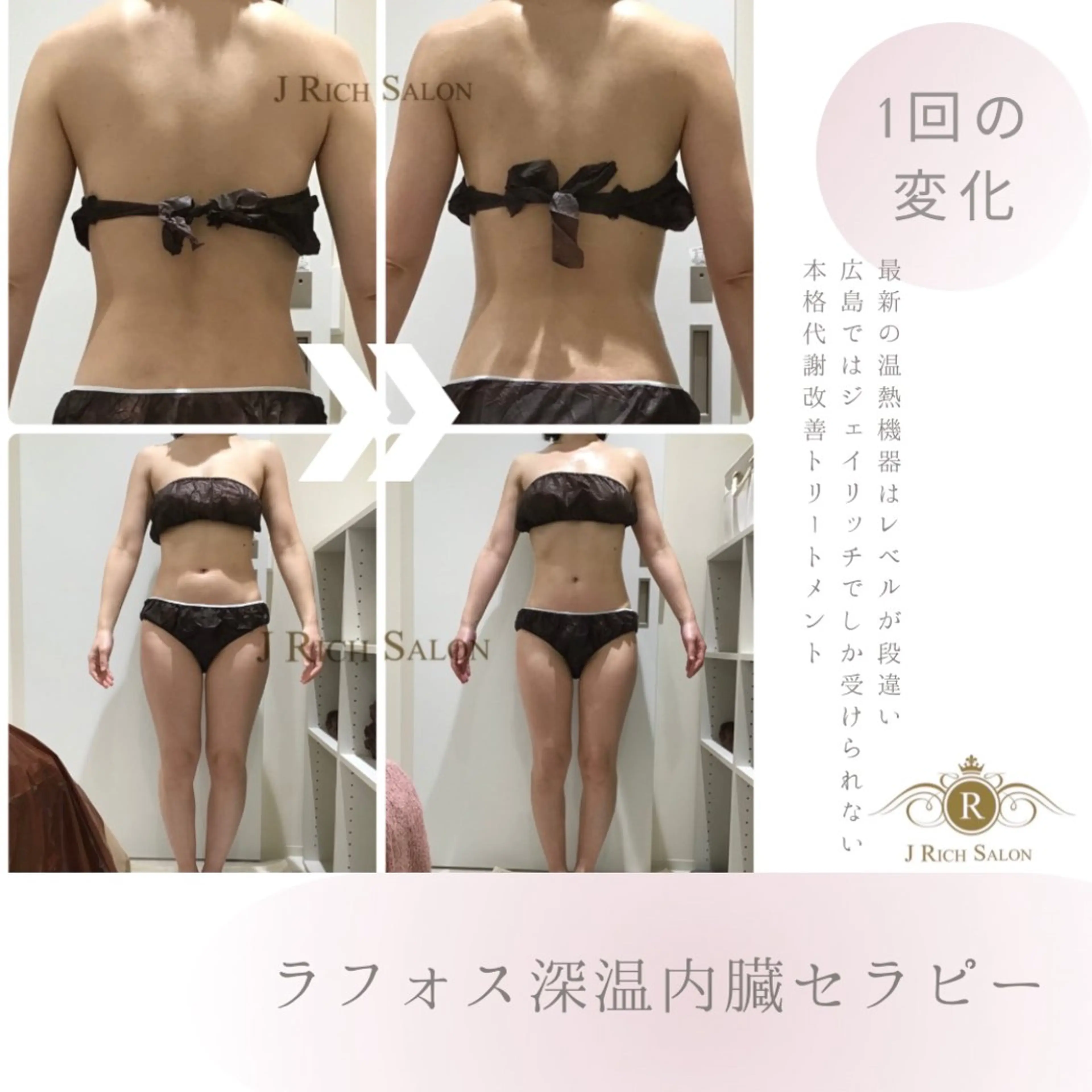 エステ リラク ジェイリッチサロン 体質改善・韓国肌管理のエステ・リラクイメージ