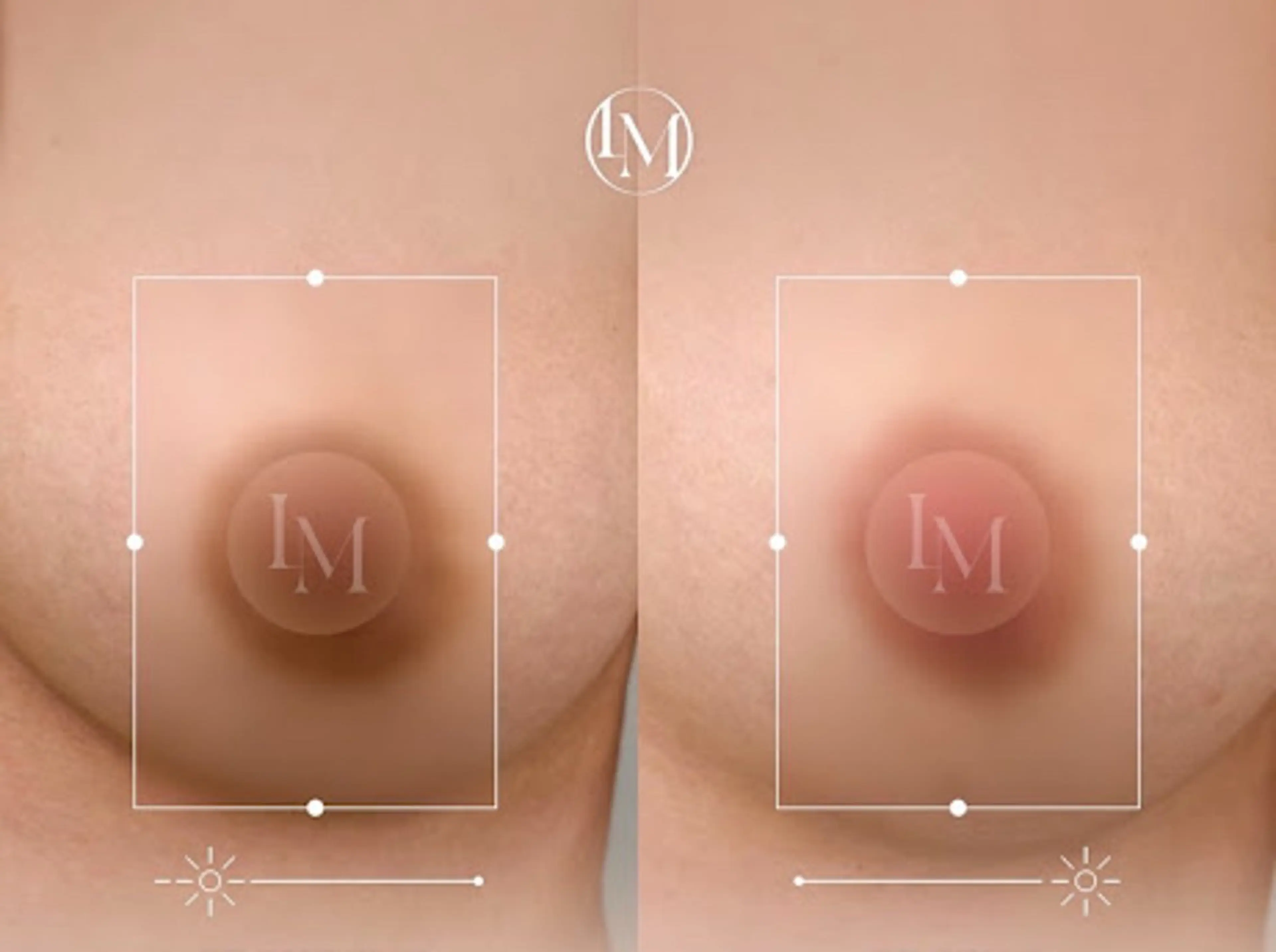メラニンケア　乳輪の写真