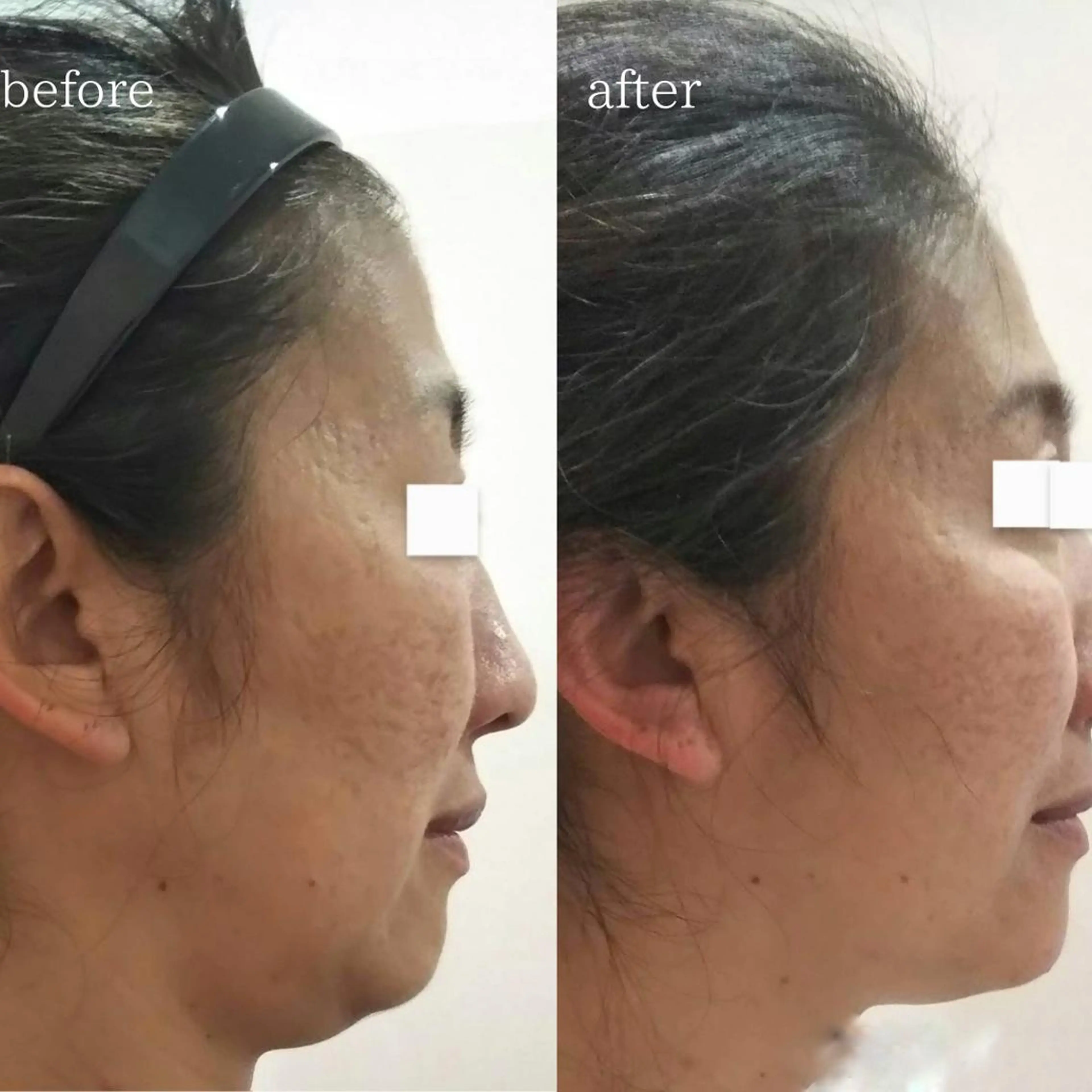 小顔痩身インディバ Nana表参道のエステ・リラクイメージ