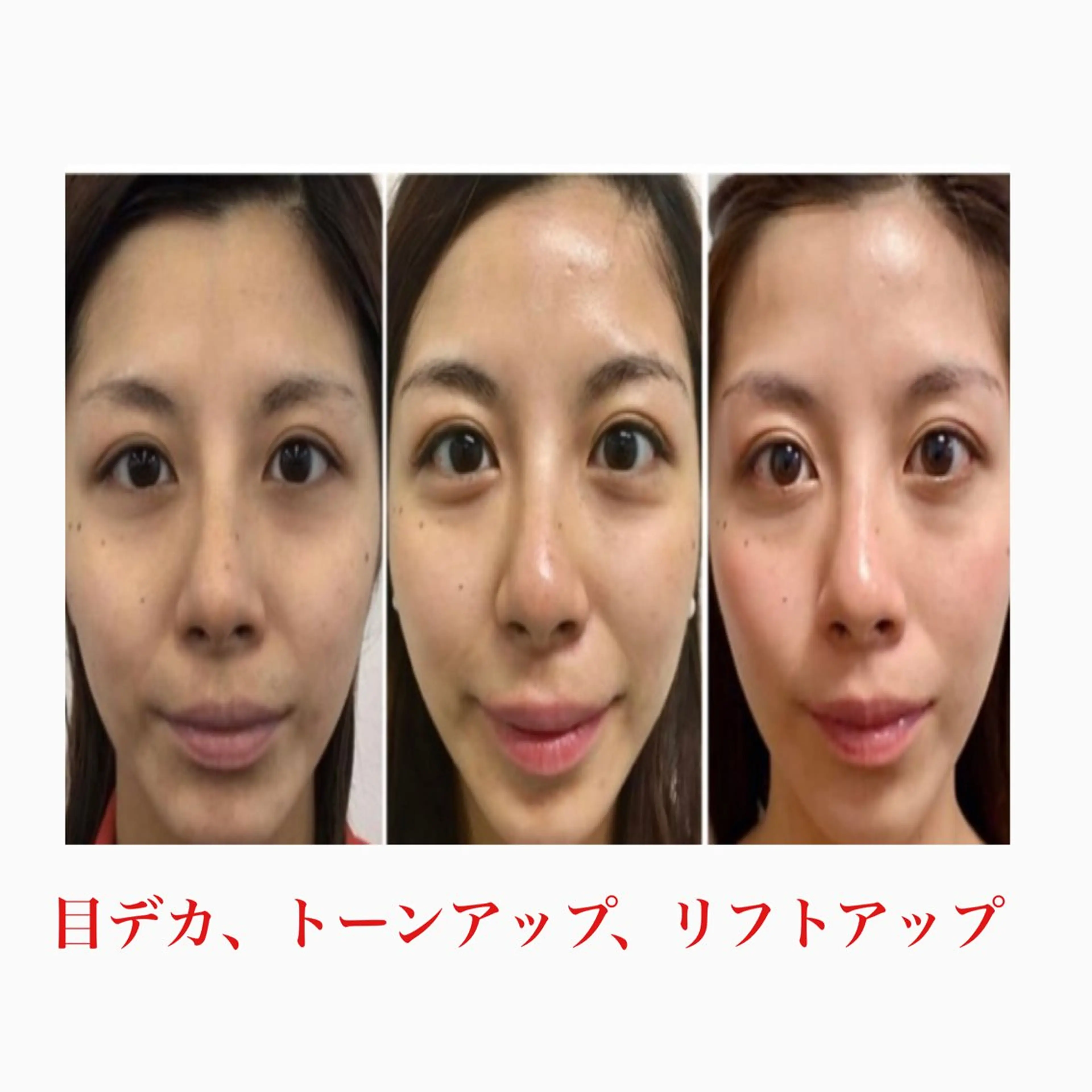 オアシス・さくら所属・中村貴子都度払い脱毛 小顔コルギのエステ・リラクイメージ