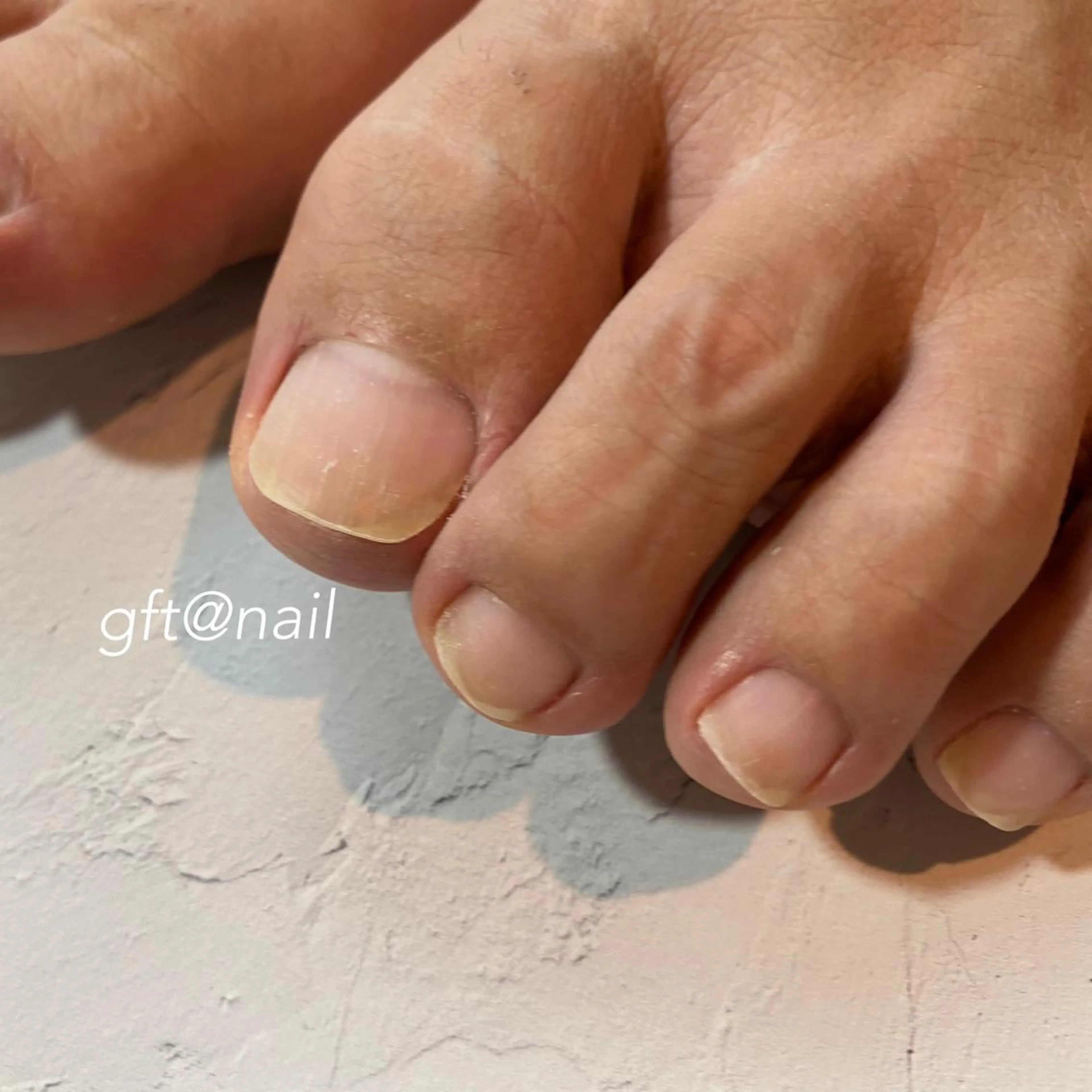 ネイル フットネイル オフのみ(ネイル) etorca nailのネイルデザイン