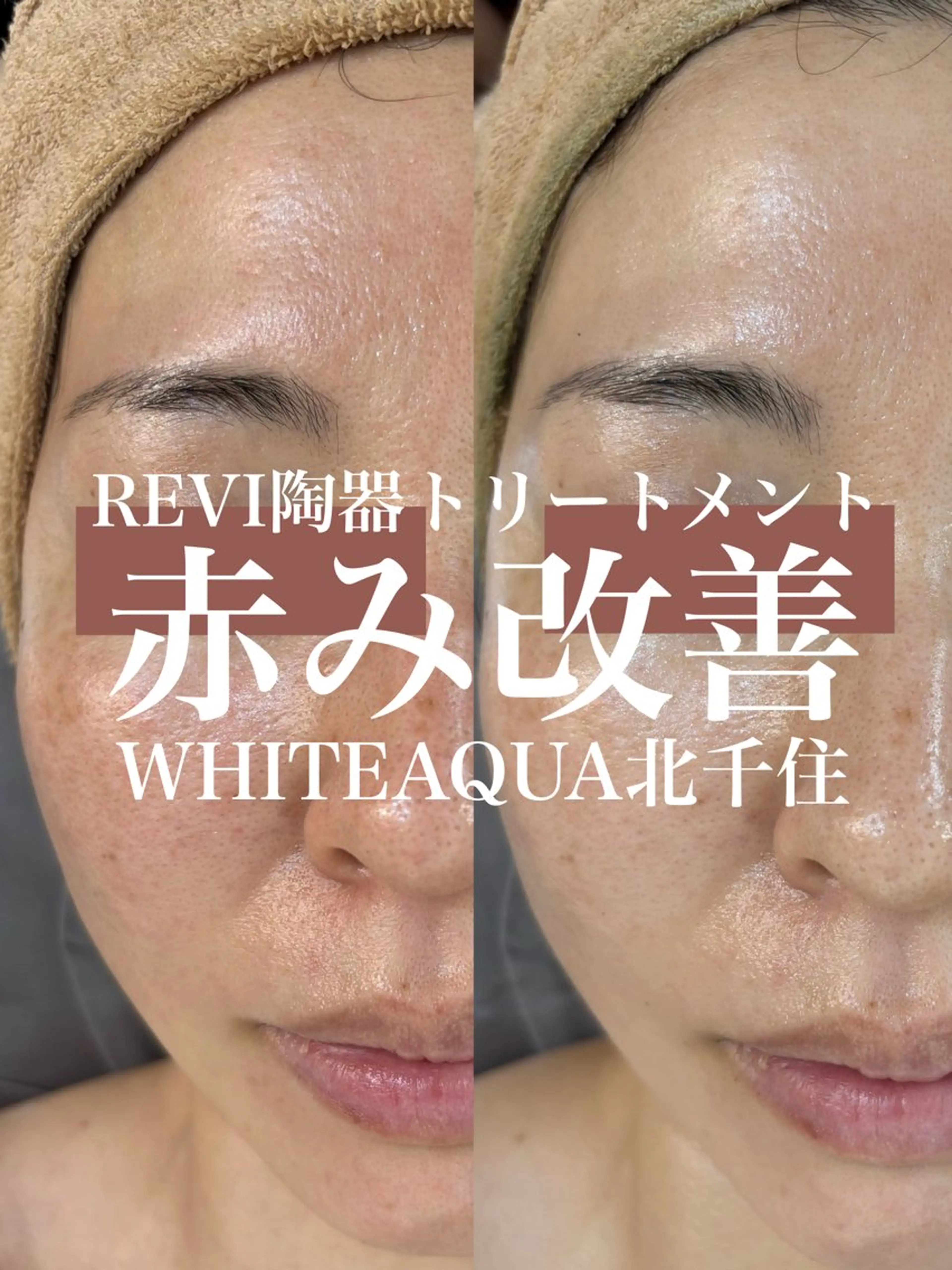 エステ WHITE AQUA 北千住店のエステ・リラクイメージ