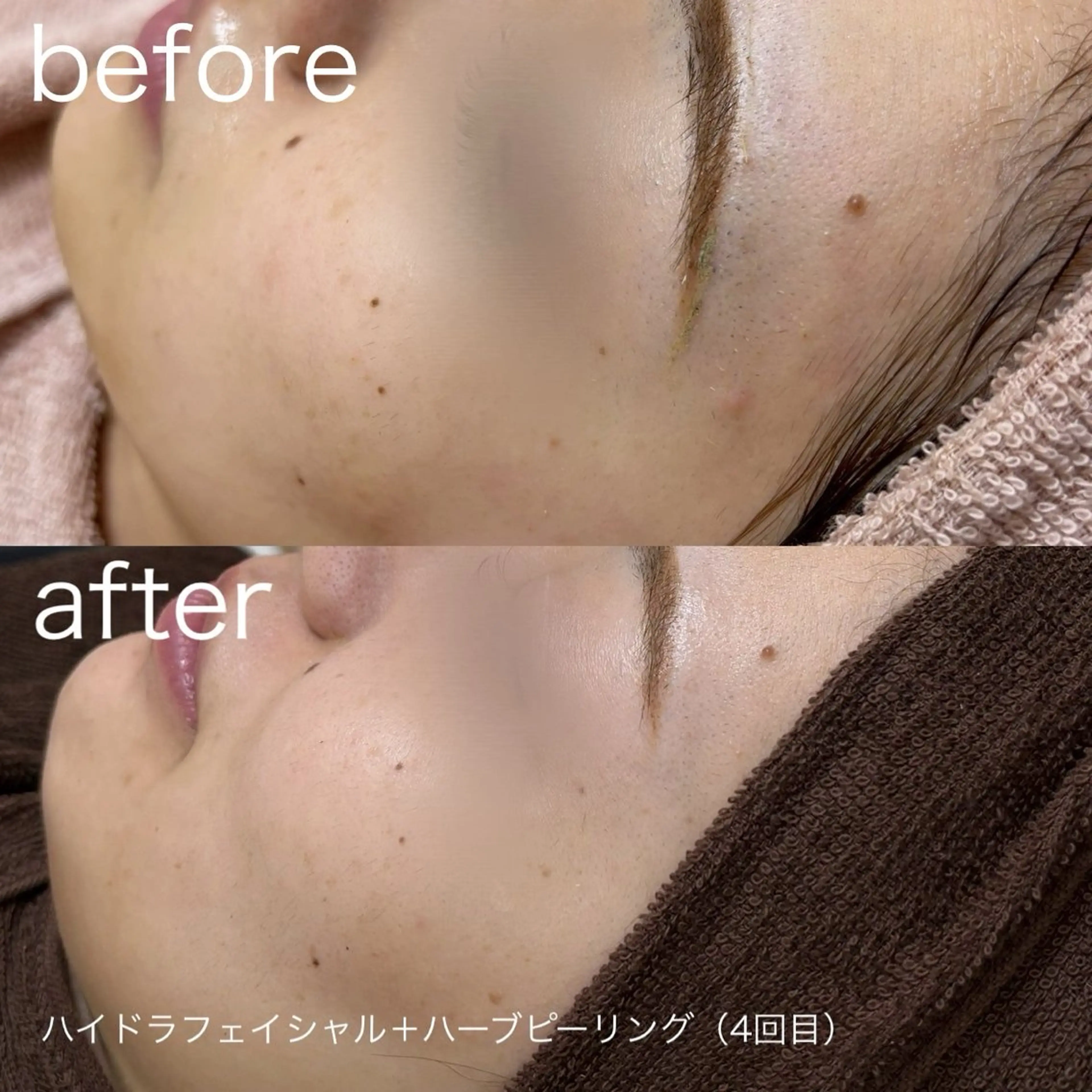 その他 lulularico Yu🫧のエステ・リラクイメージ