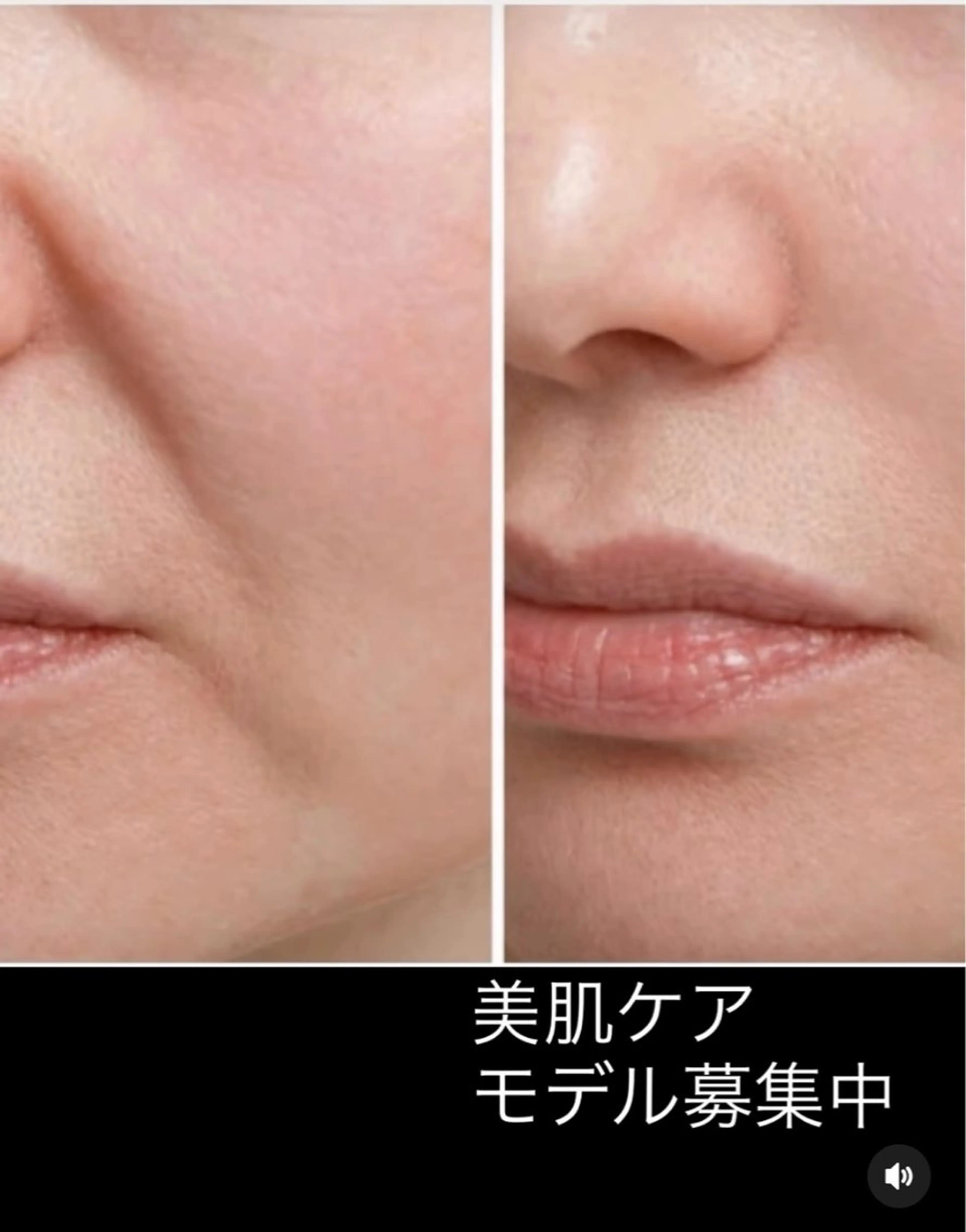 フェイスエステの写真