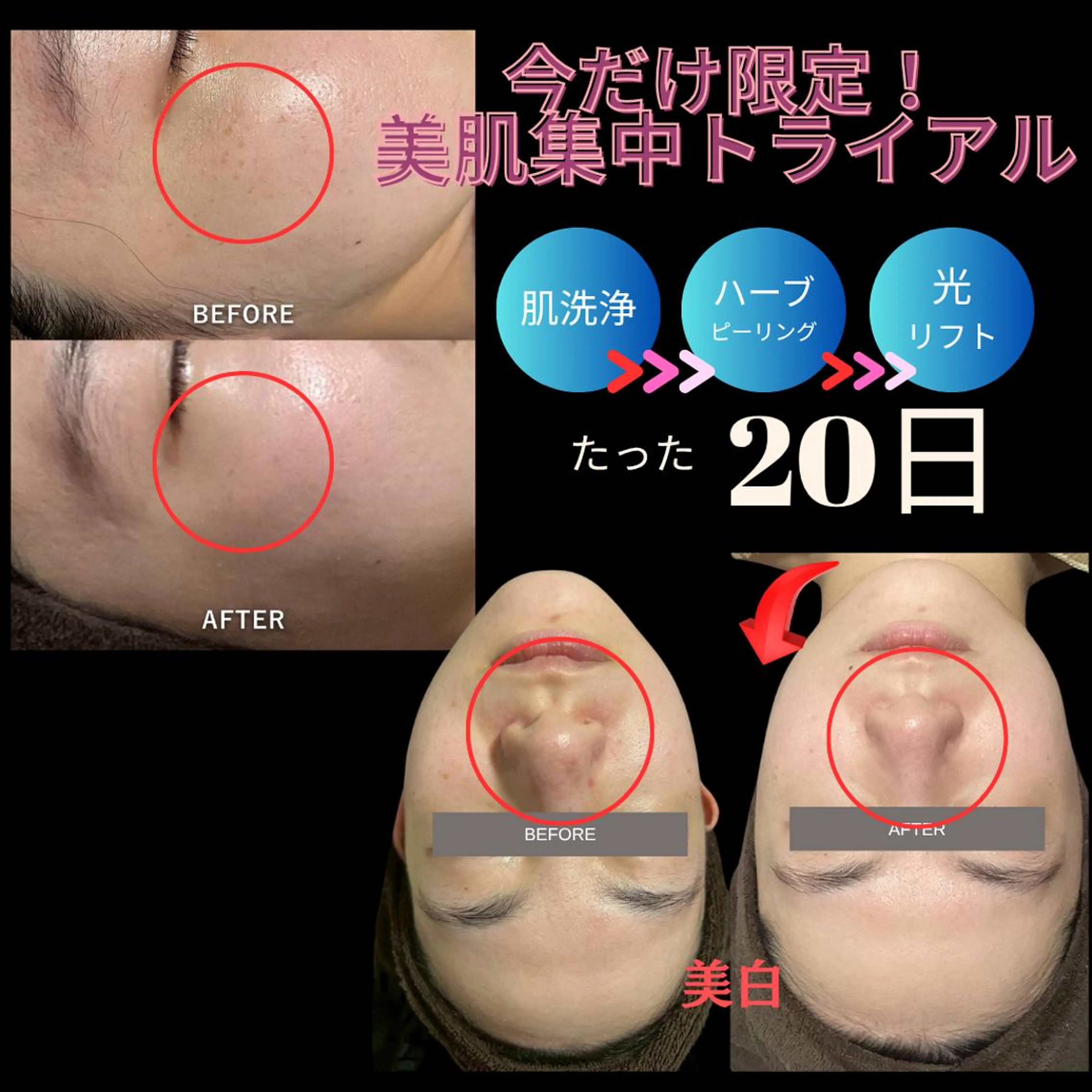 💎1か月集中通いたい放題💎美肌トライアル/今だけ残り2名❣の写真