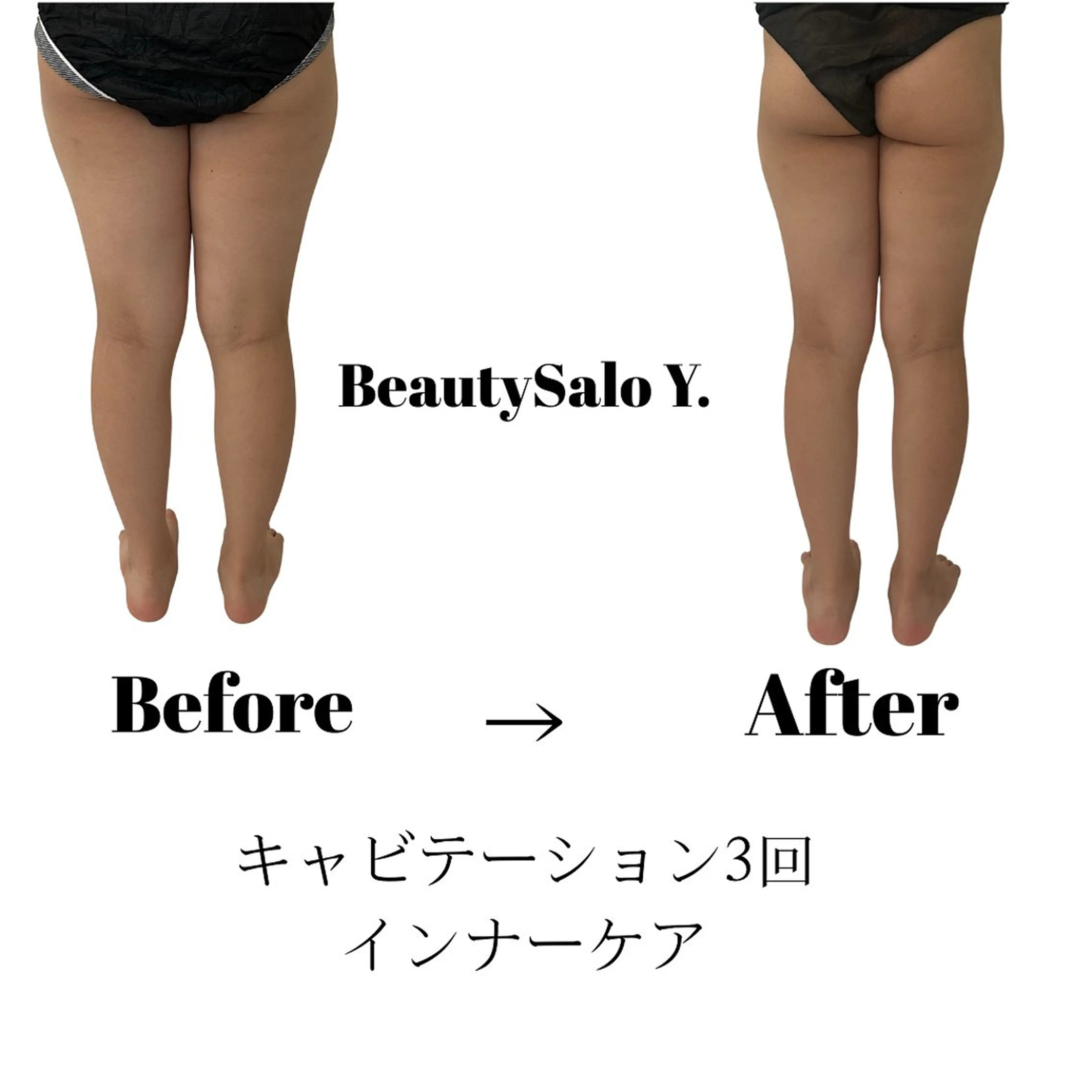 【ダイエットサロン気になるけど…まずはお試し】脂肪を落とすキャビテーション&ダイエットリンパマッサージ30分の写真