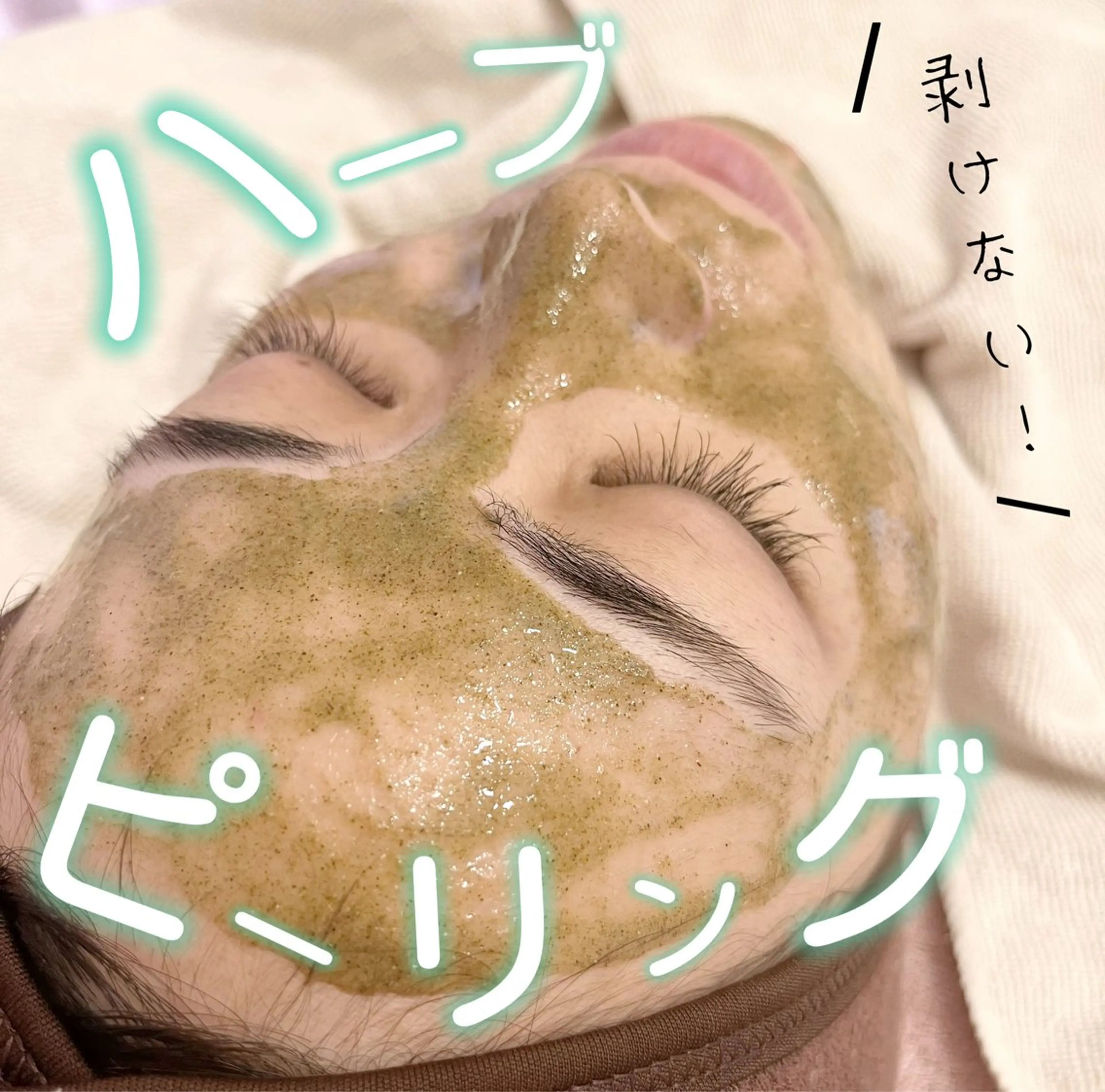 3回まで同価格！【ニキビケア・肌質改善人気NO.1】剥離なしハーブピーリングの写真