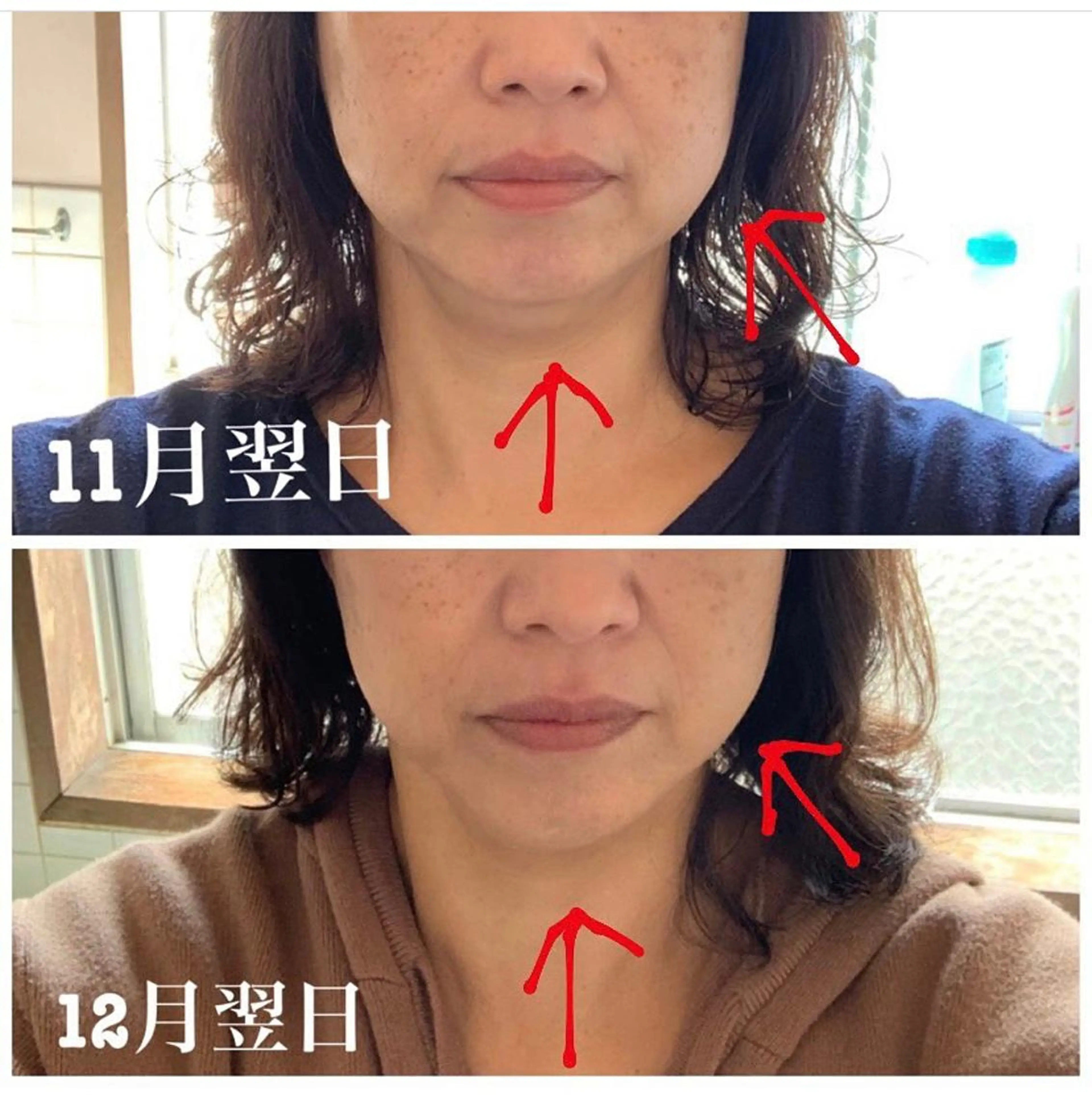 エステ リラク 小顔と ヘッドスパのお店のエステ・リラクイメージ