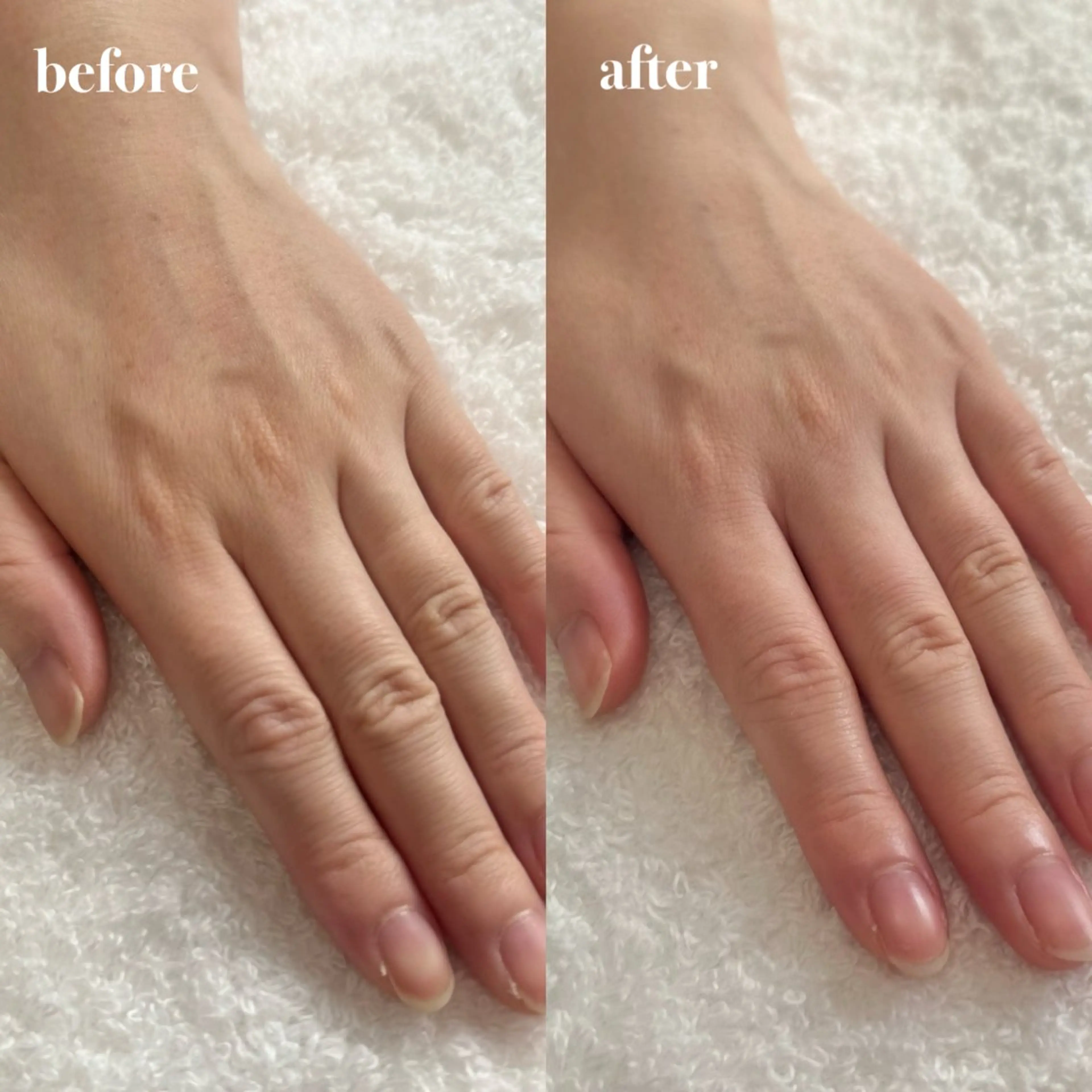 エステ 'amo nail atelierのエステ・リラクイメージ