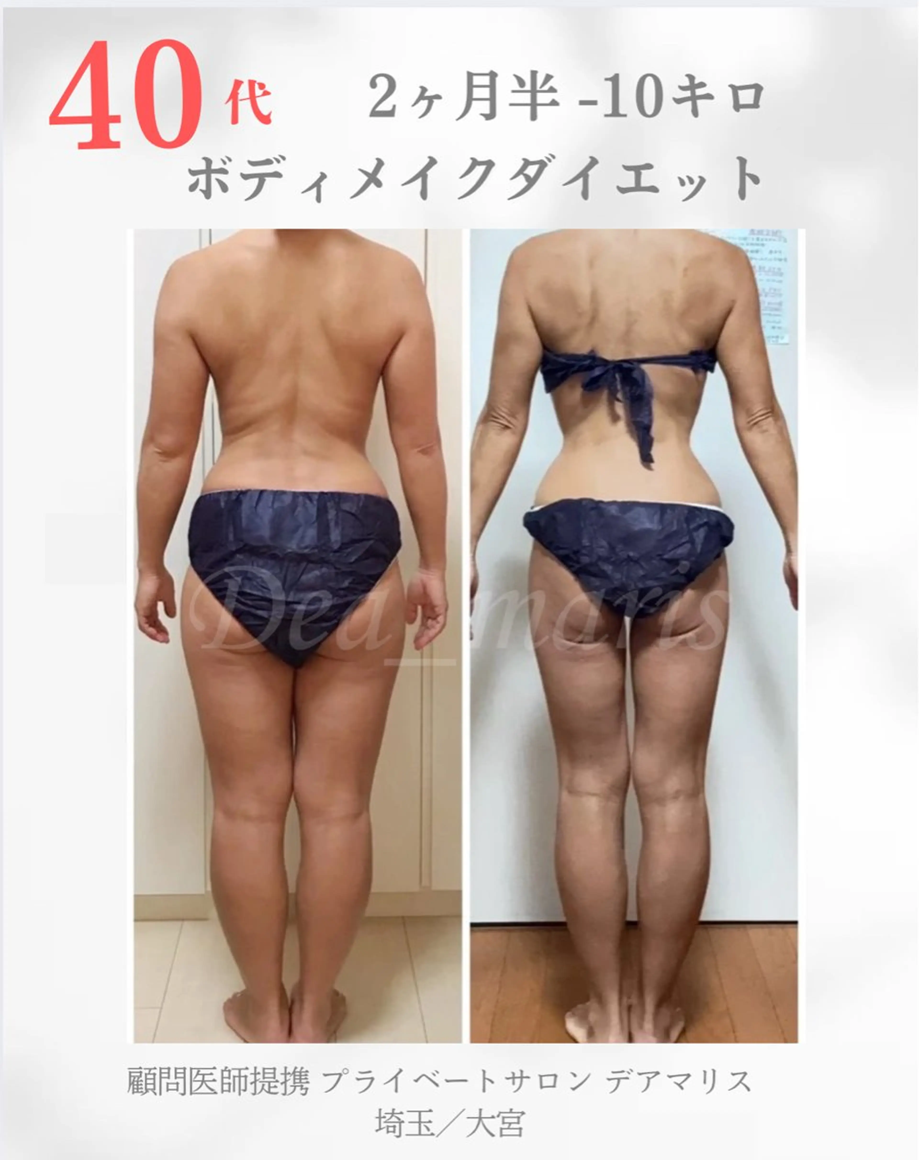 private salon  Dea_maris シュガーリング＆パーソナルボディケア所属・ダイエット難民が通う 10キロダイエットのその他イメージ