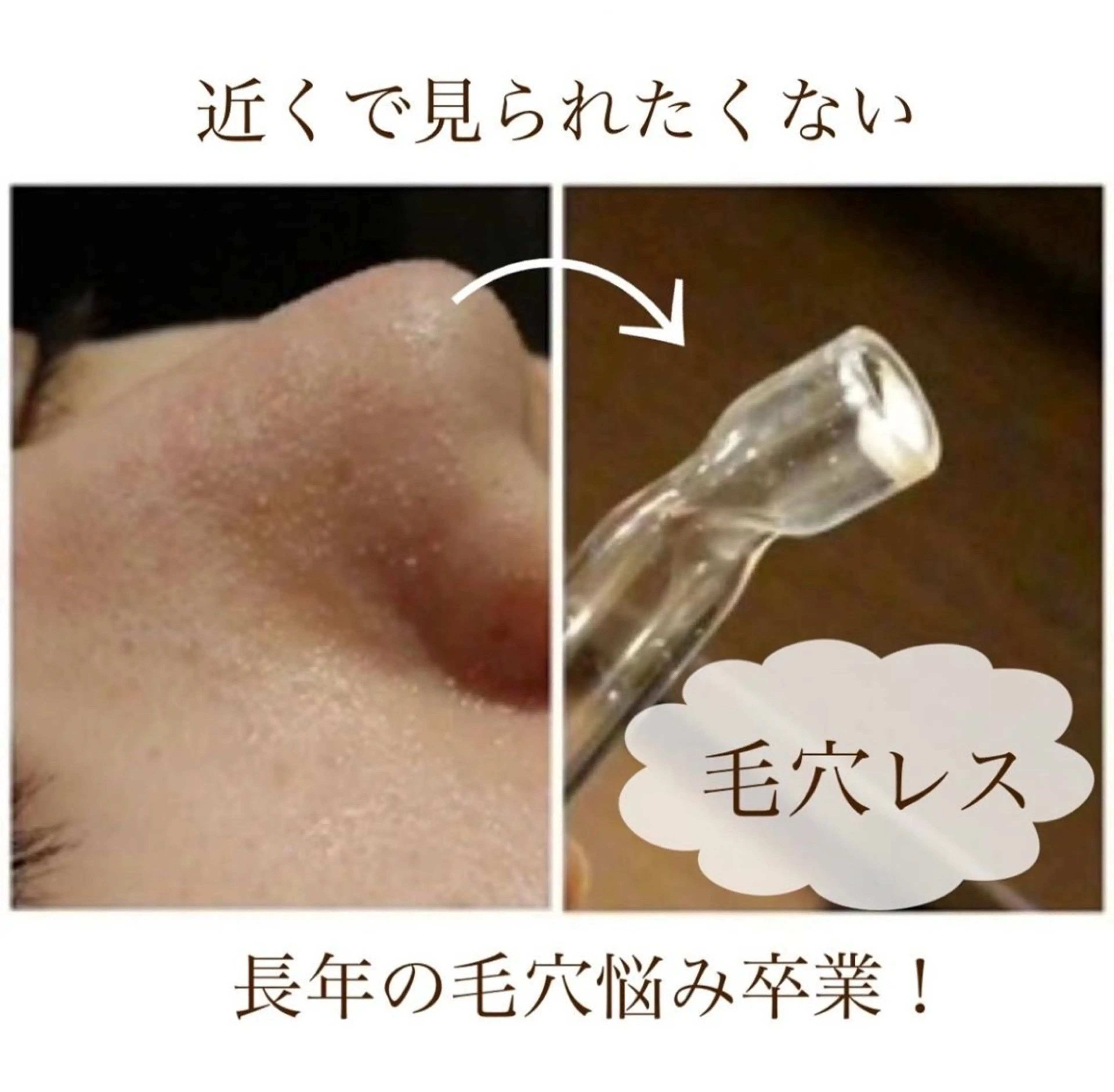 〈人気NO.1〉毛穴の角栓・黒ずみ撃退！いちご鼻卒業🍓👋毛穴レスショートコース60分の写真