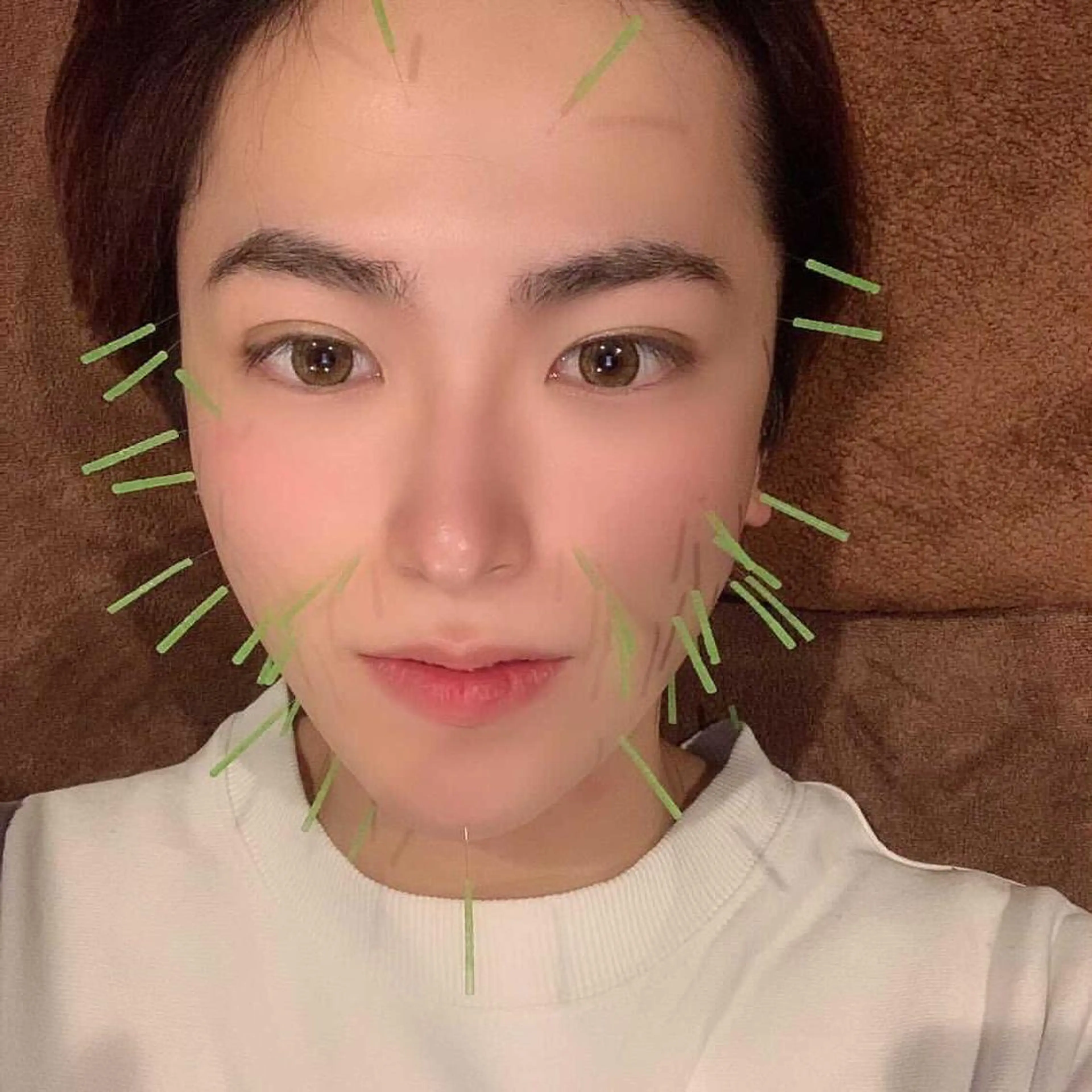 エステ リラク 美容鍼灸サロン LOMIHARIのエステ・リラクイメージ