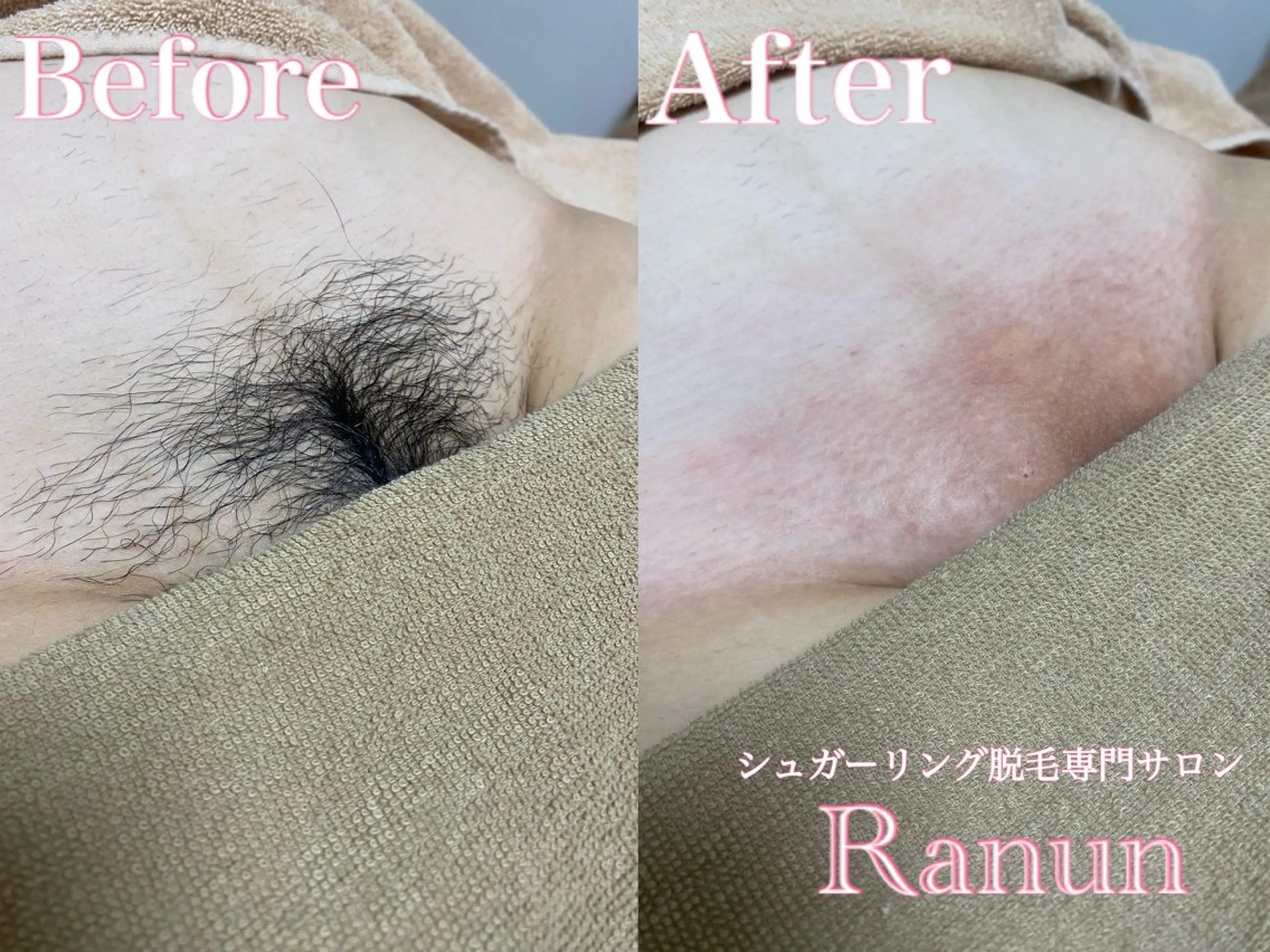 マツエク・マツパ シュガーリング脱毛 専門店Ranunのエステ・リラクイメージ
