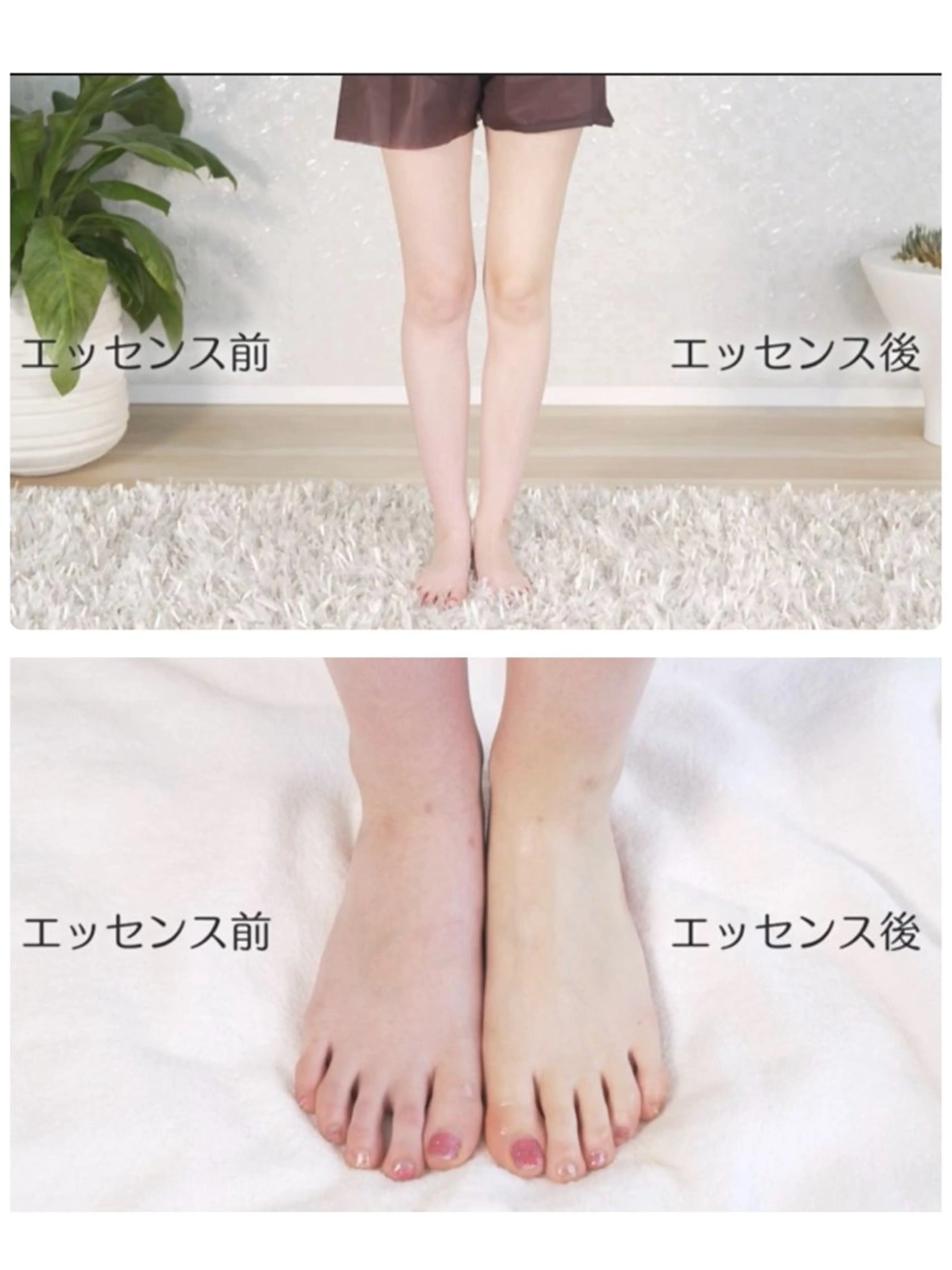 💒ブライダル全身トリートメント💒浮腫み解消、浮腫みにくい身体へ🩷メリハリのある身体へ👗の写真