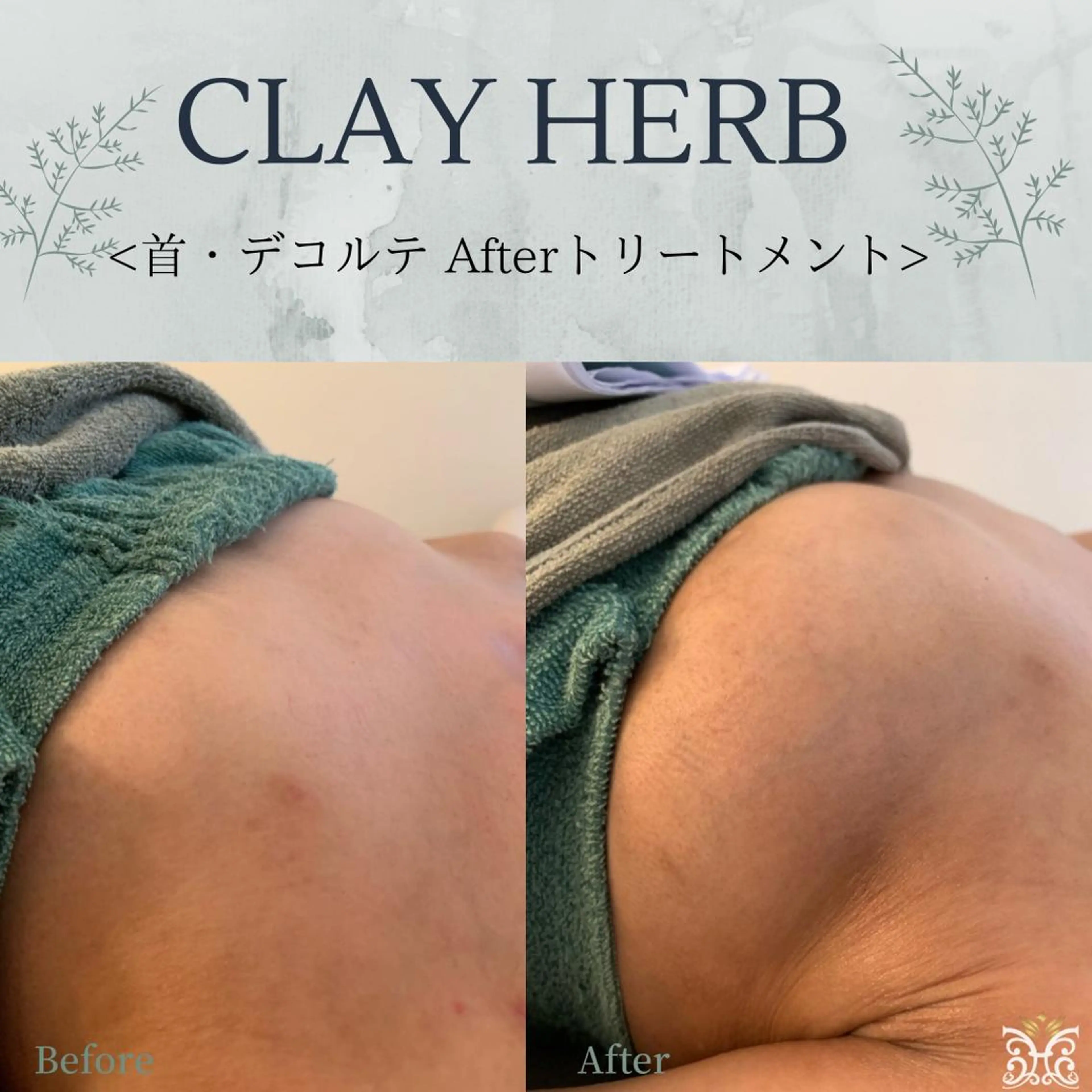 エステ リラク 【剥離ありハーブピーリング専門エステ】cerisier BEAUTÉ 原宿所属・cerisier BEAUTÉのエステ・リラクイメージ