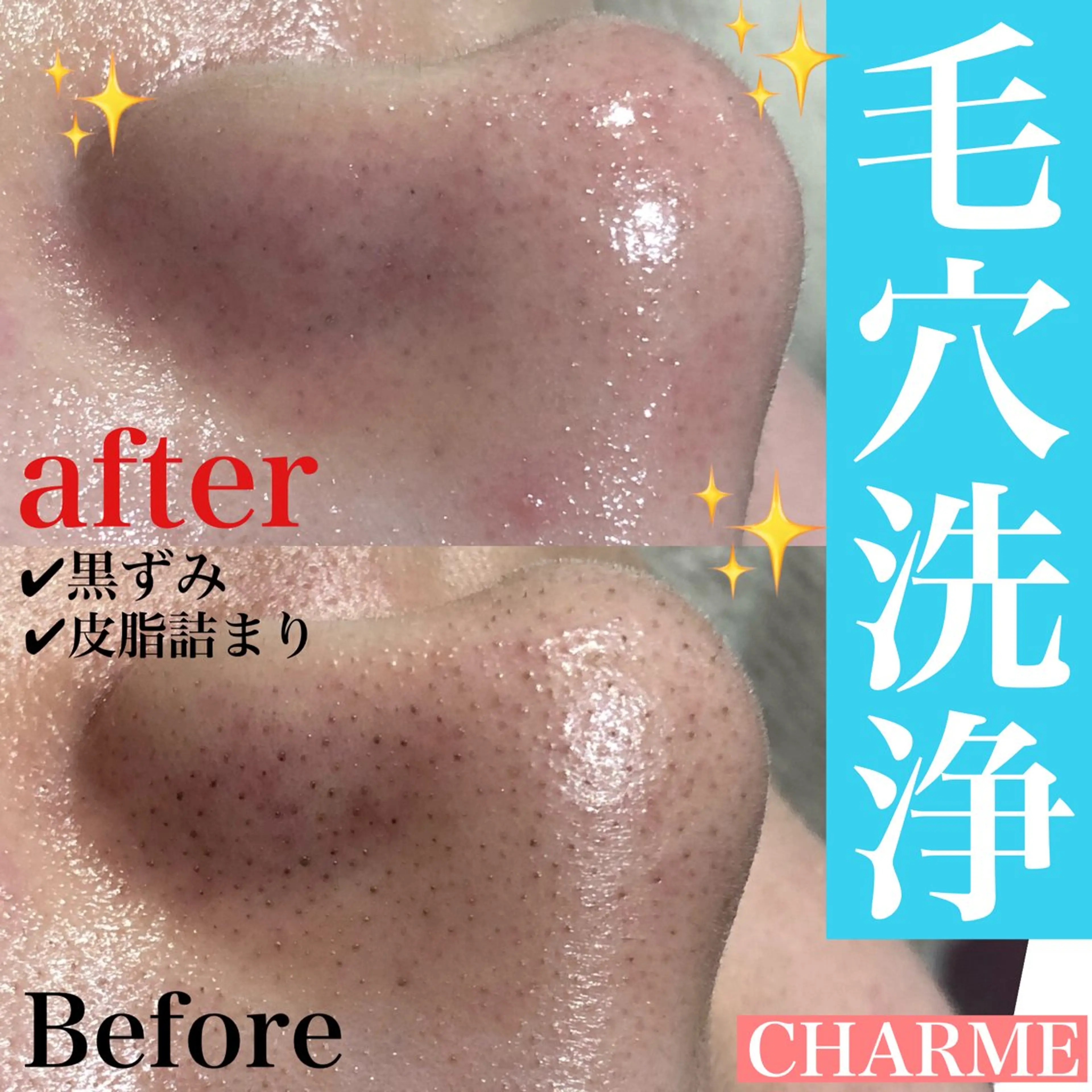 CHARME所属・CHARME エステサロンのエステ・リラクイメージ