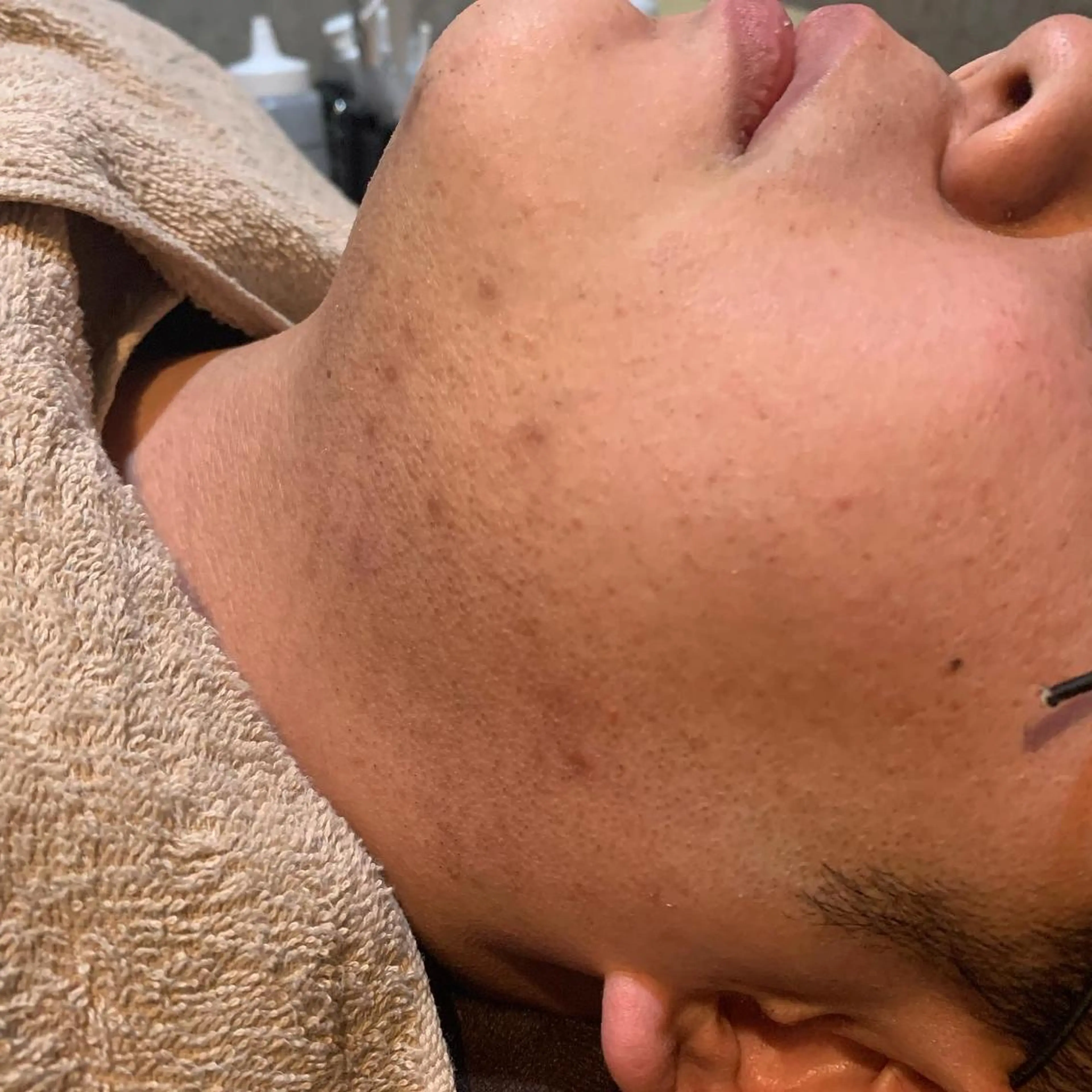 メンズ 20代から始める脱毛 salonLEPIAのエステ・リラクイメージ
