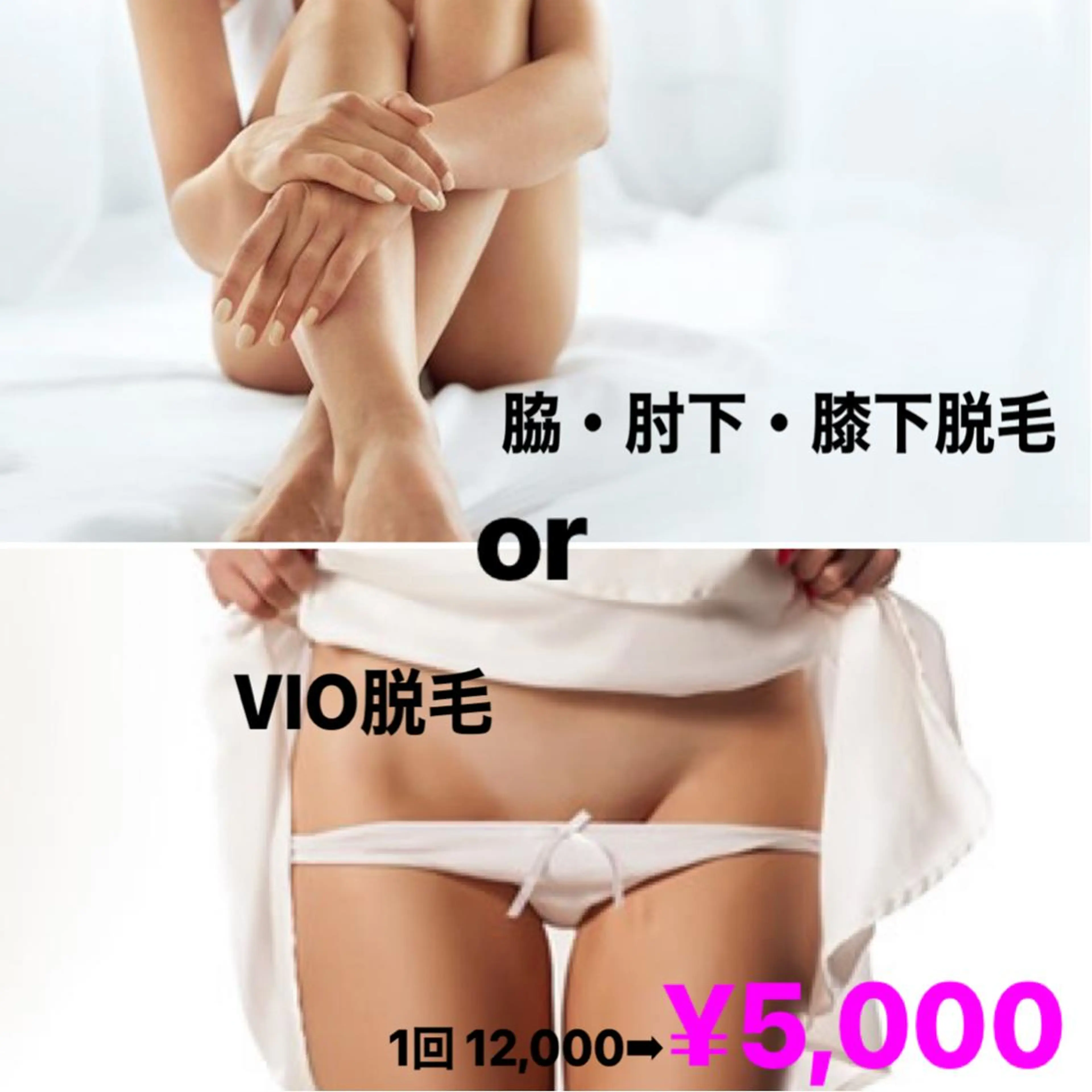 ❥女性ご新規様限定 ❥ ‧✧̣̥̇‧選べる人気部位‧✧̣̥̇‧【VIOまるごと or 脇+ひじ下+ひざ下】美肌脱毛 1回の写真