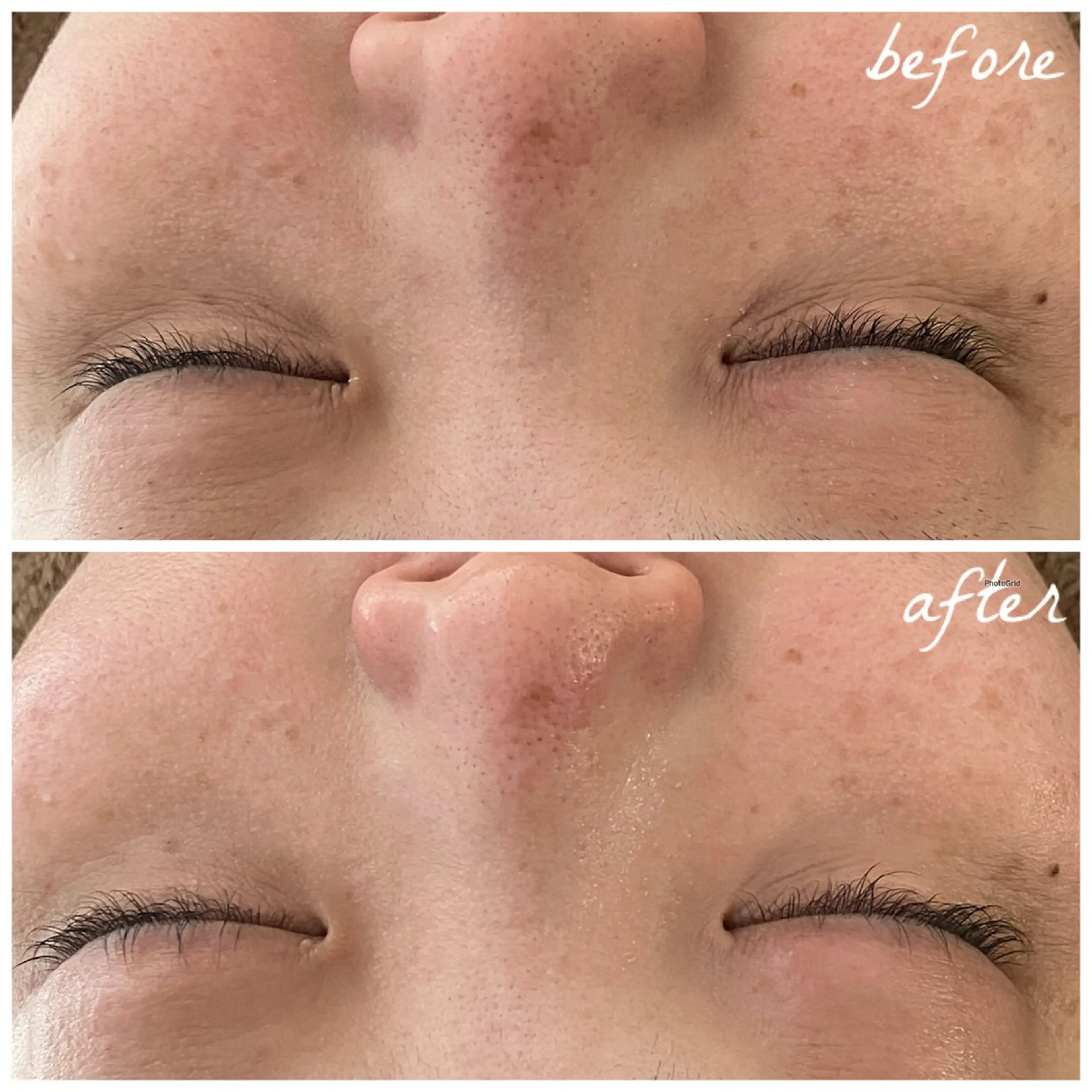 メンズ エステ メナード岐阜茜部 杉浦のエステ・リラクイメージ