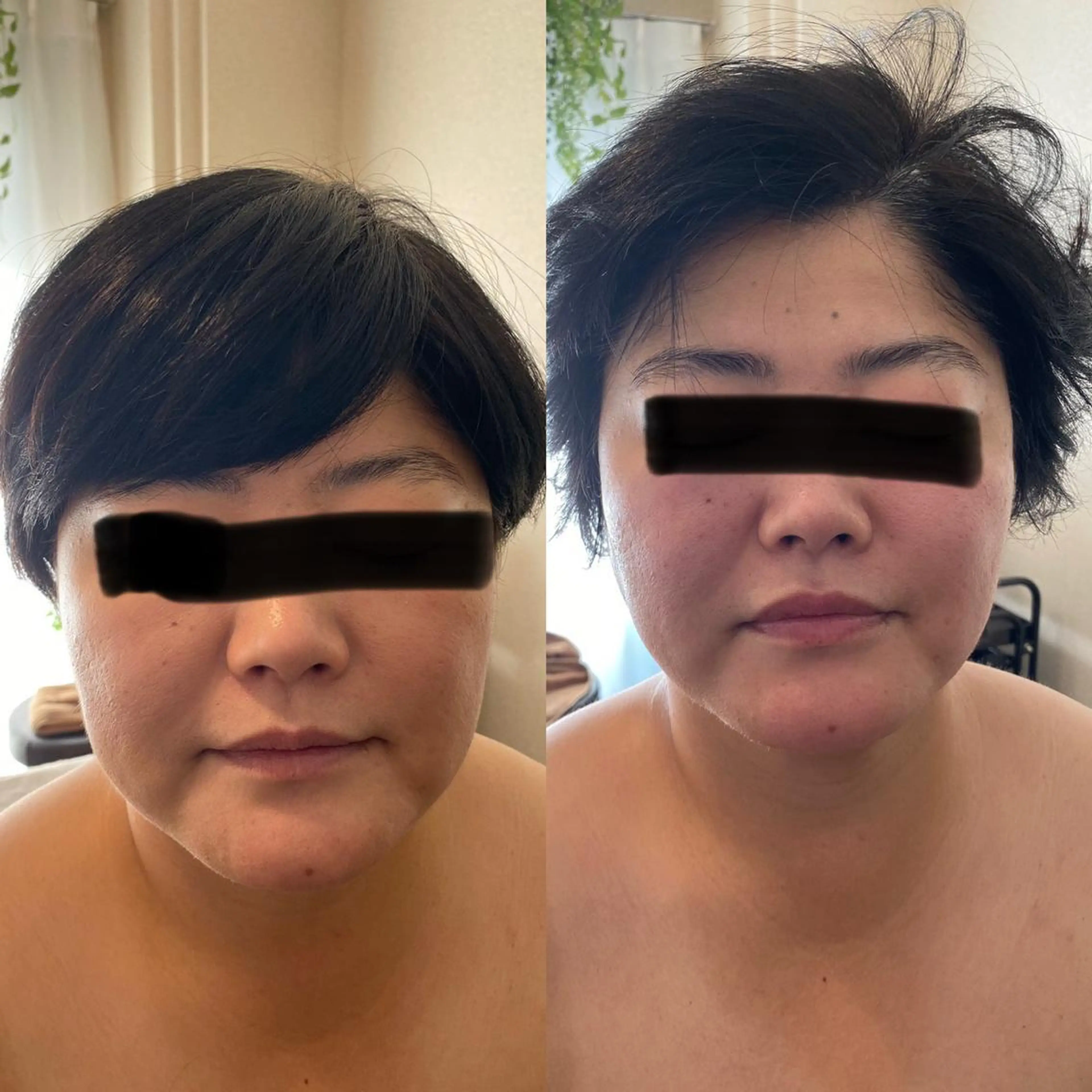 Meetite 小林のエステ・リラクイメージ