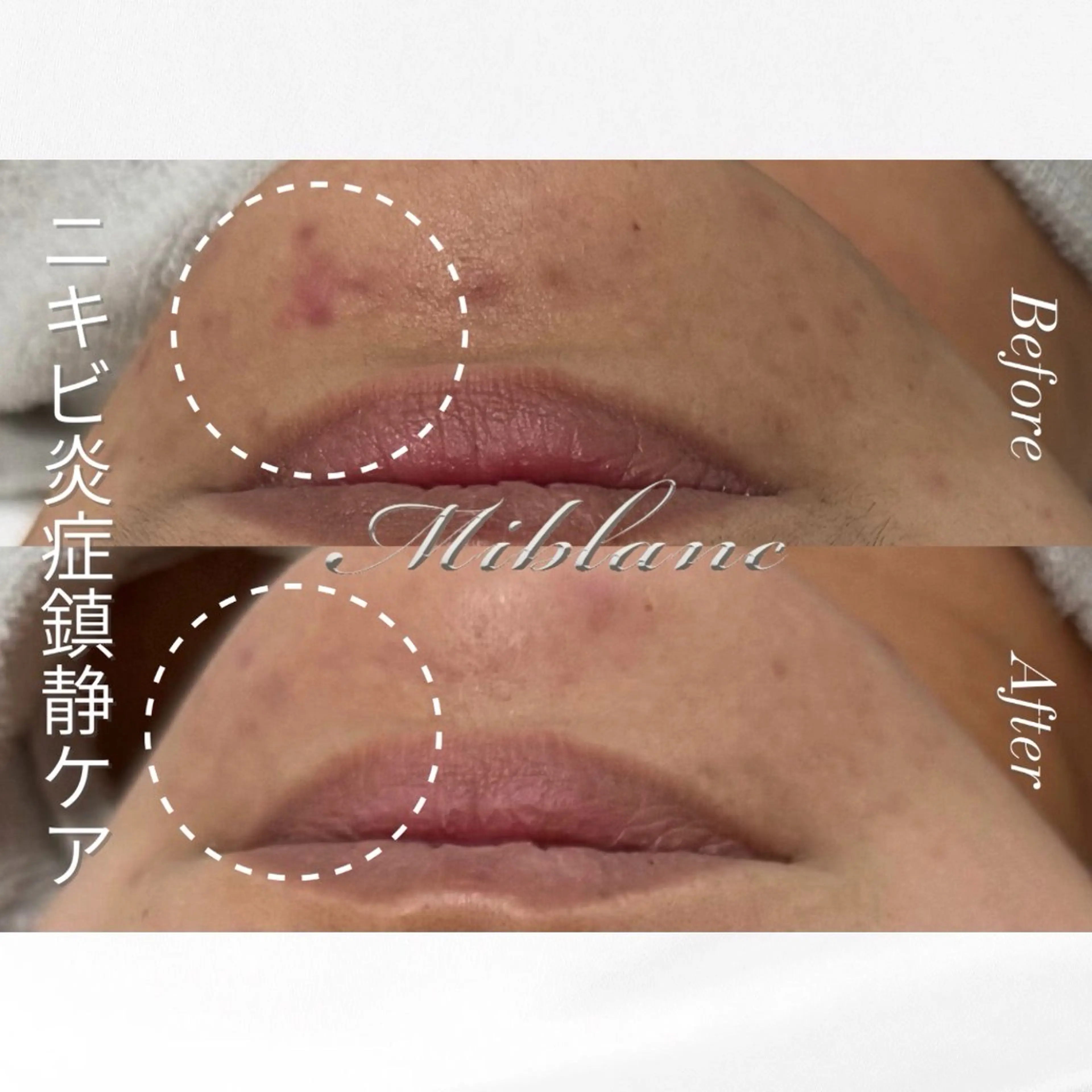 肌質管理 MIBLANC上野店のその他イメージ