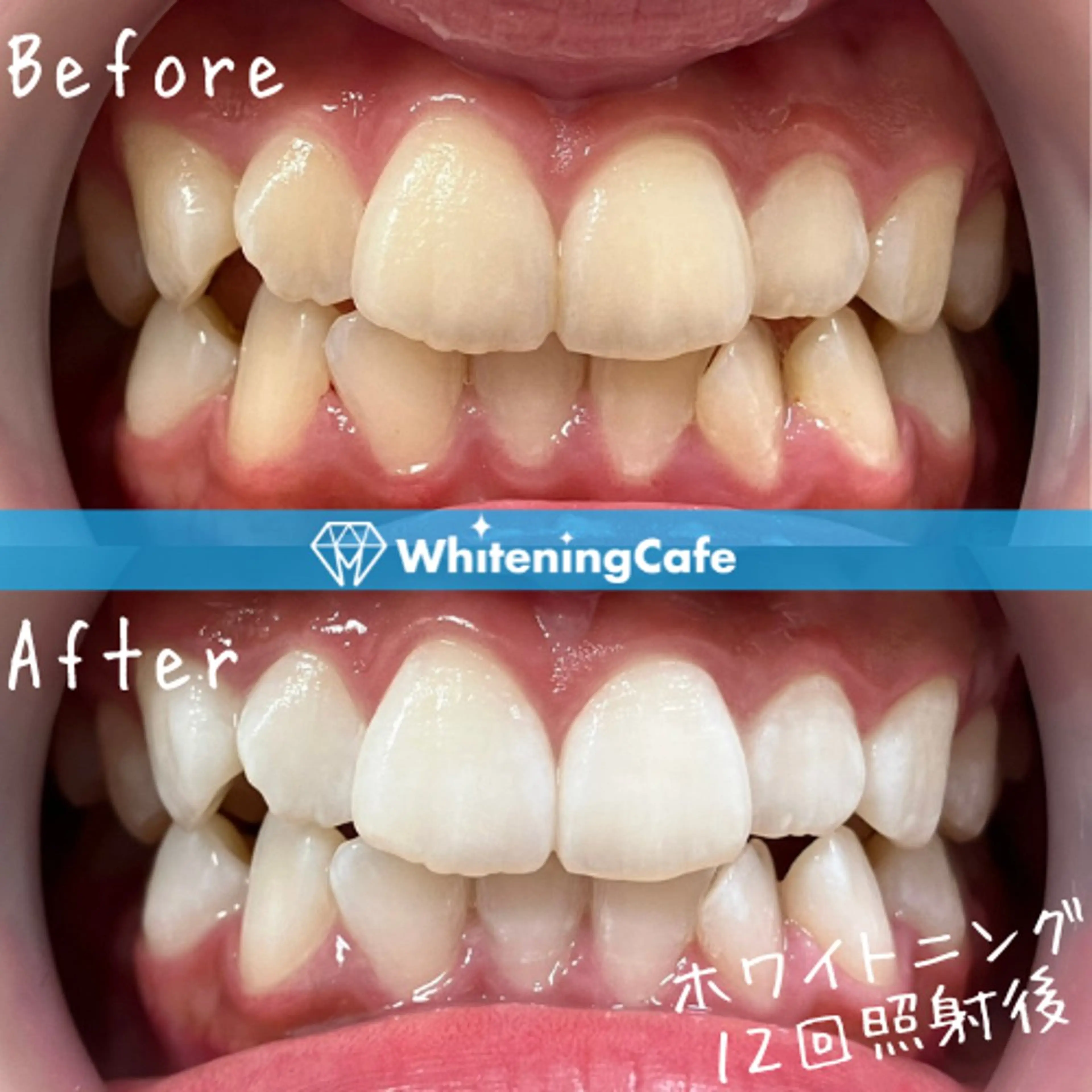 ホワイトニングカフェ神戸元町店所属・ホワイトニングカフェ 神戸元町店のエステ・リラクイメージ