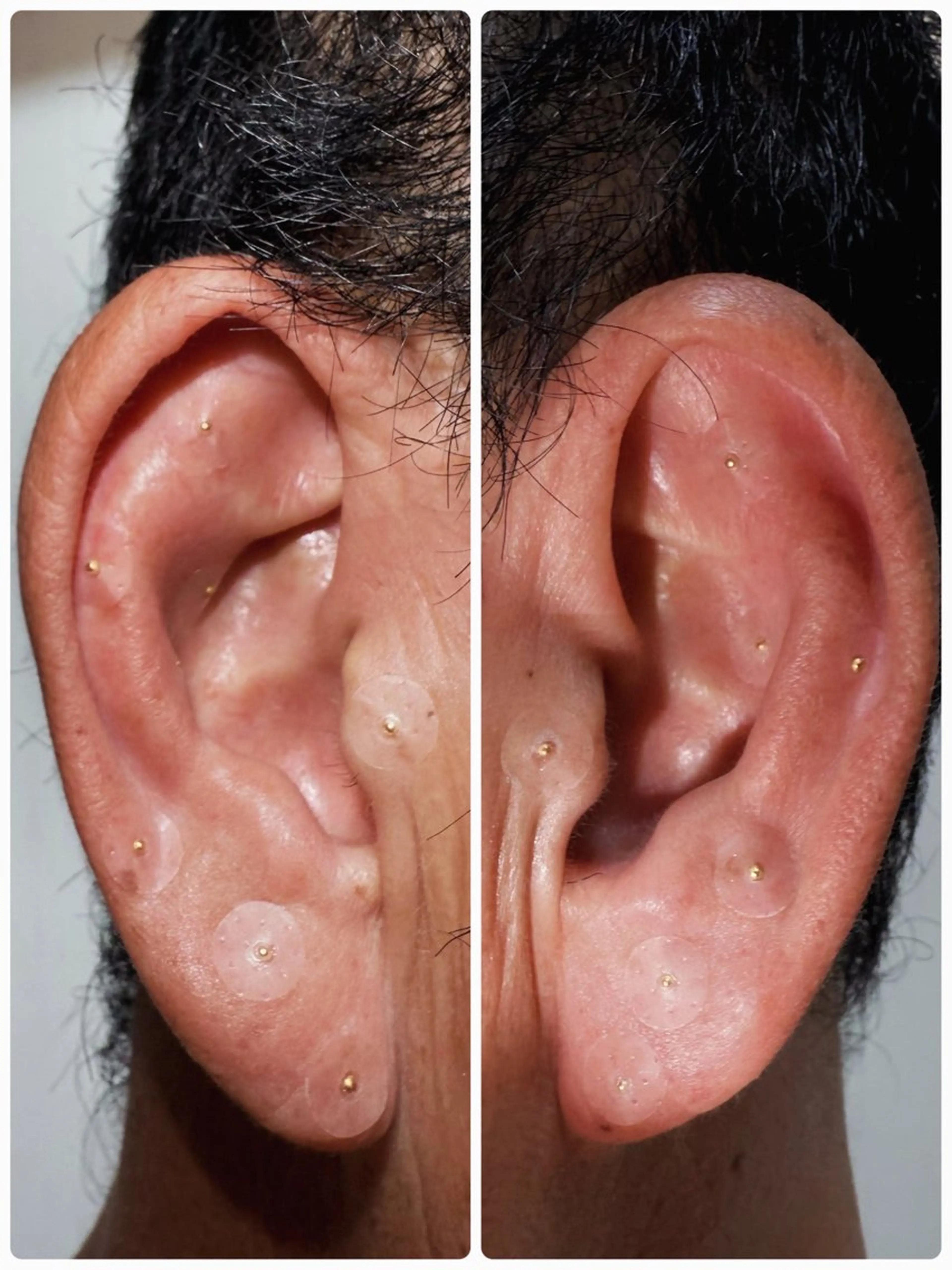👂メンズ限定👨　耳ツボシール 10粒 各5粒の写真