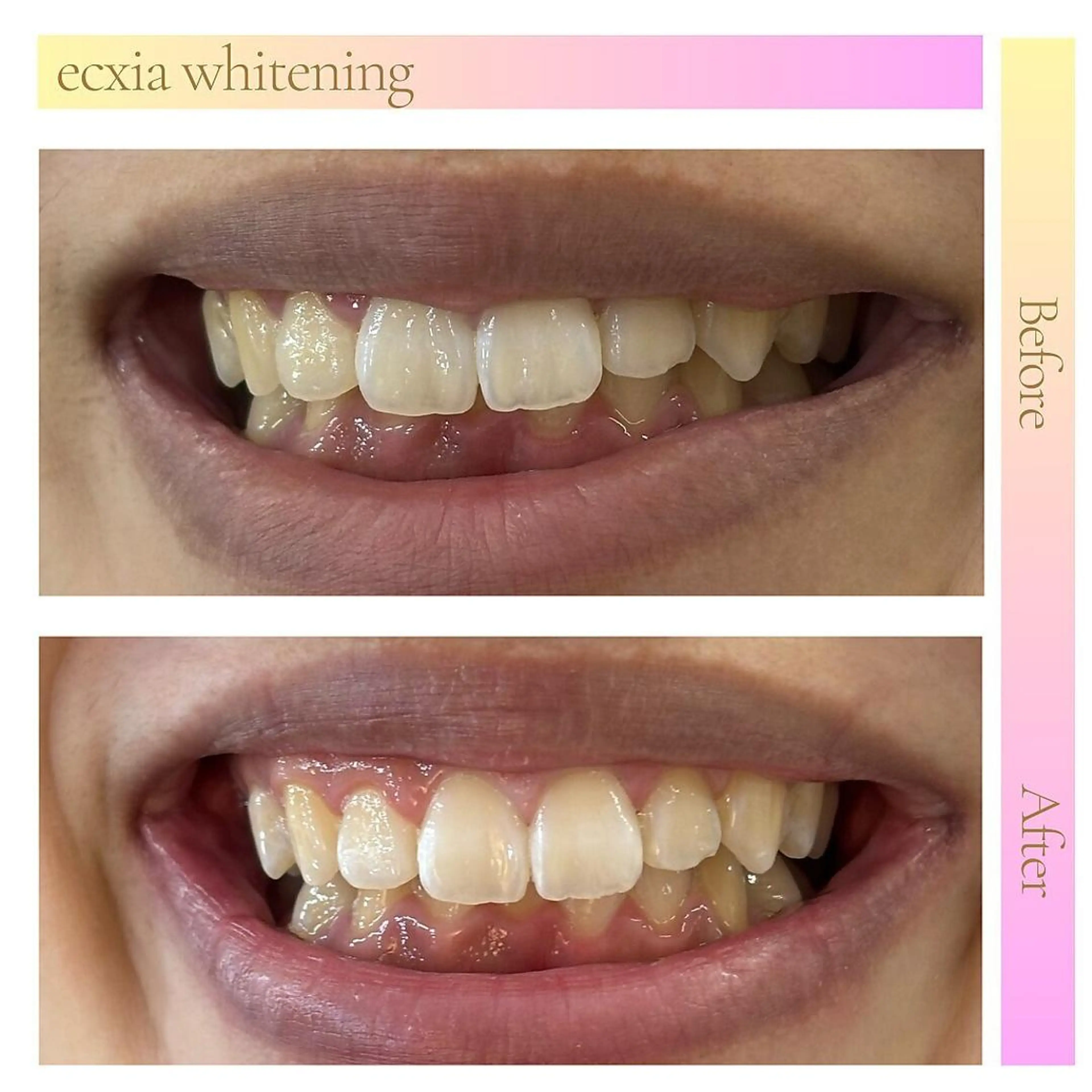 セルフホワイトニング エクシア五反田店のその他イメージ