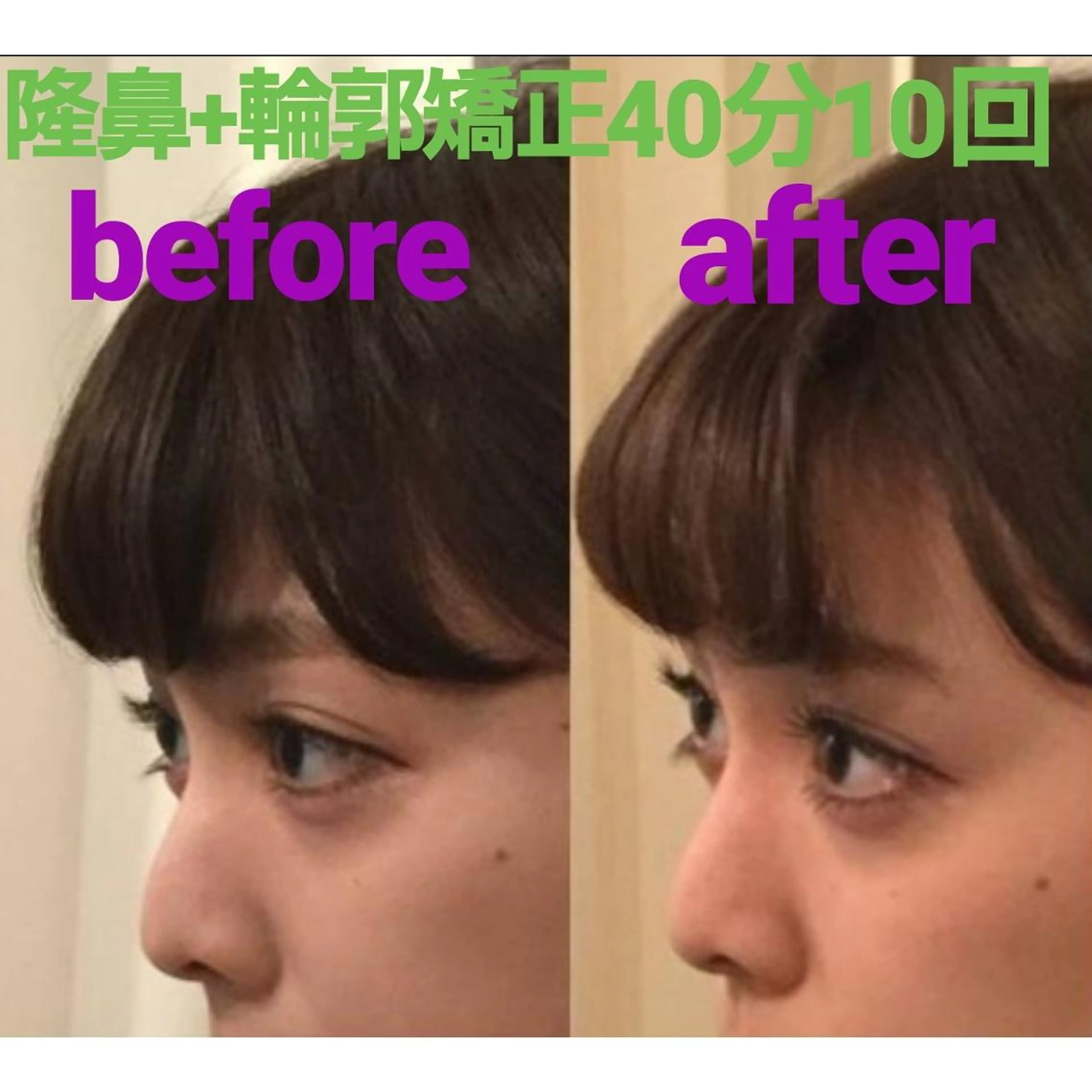 隆鼻矯正専門店ラプリ 加藤のエステ・リラクイメージ