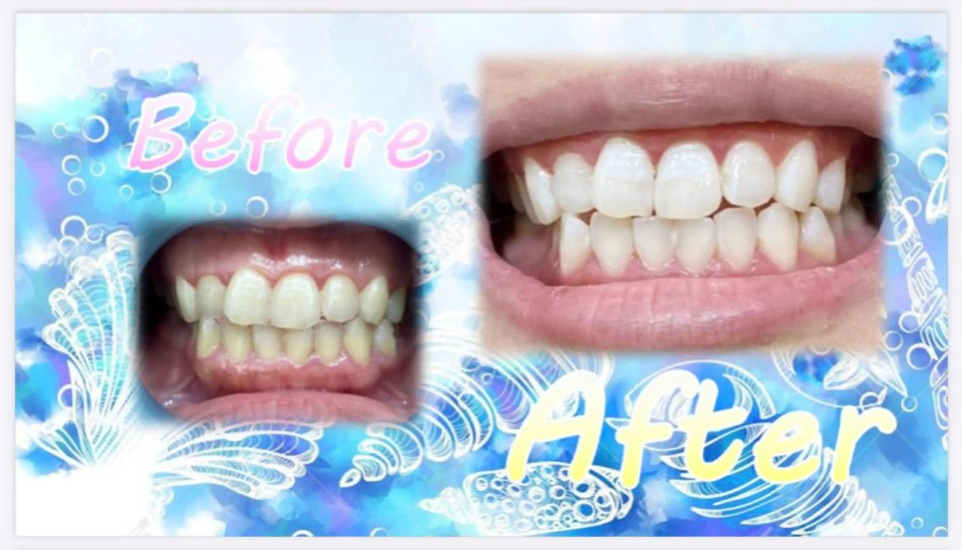 その他 セルフホワイトニングサロン　ラヴィアン所属・ホワイトニングサロン La vie enのその他イメージ