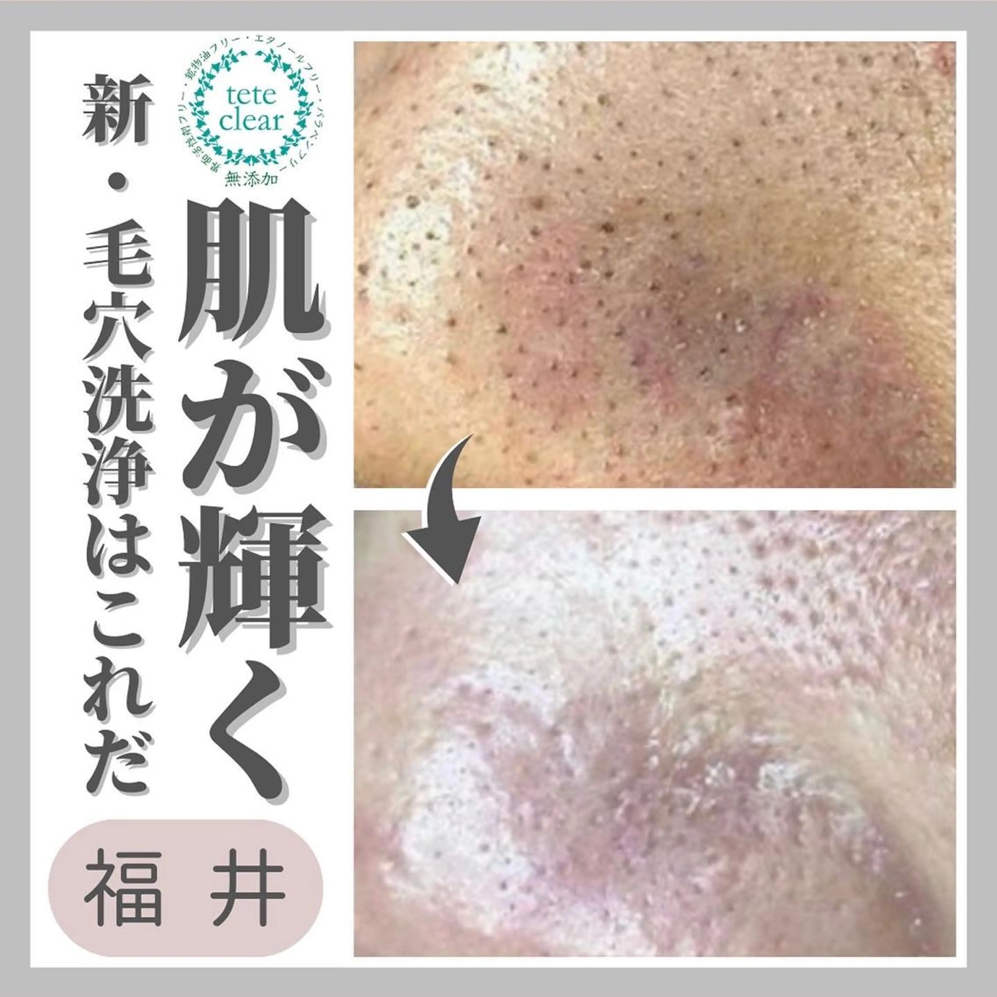 毛穴ケア専門サロン Yourmeユアミーのエステ・リラクイメージ