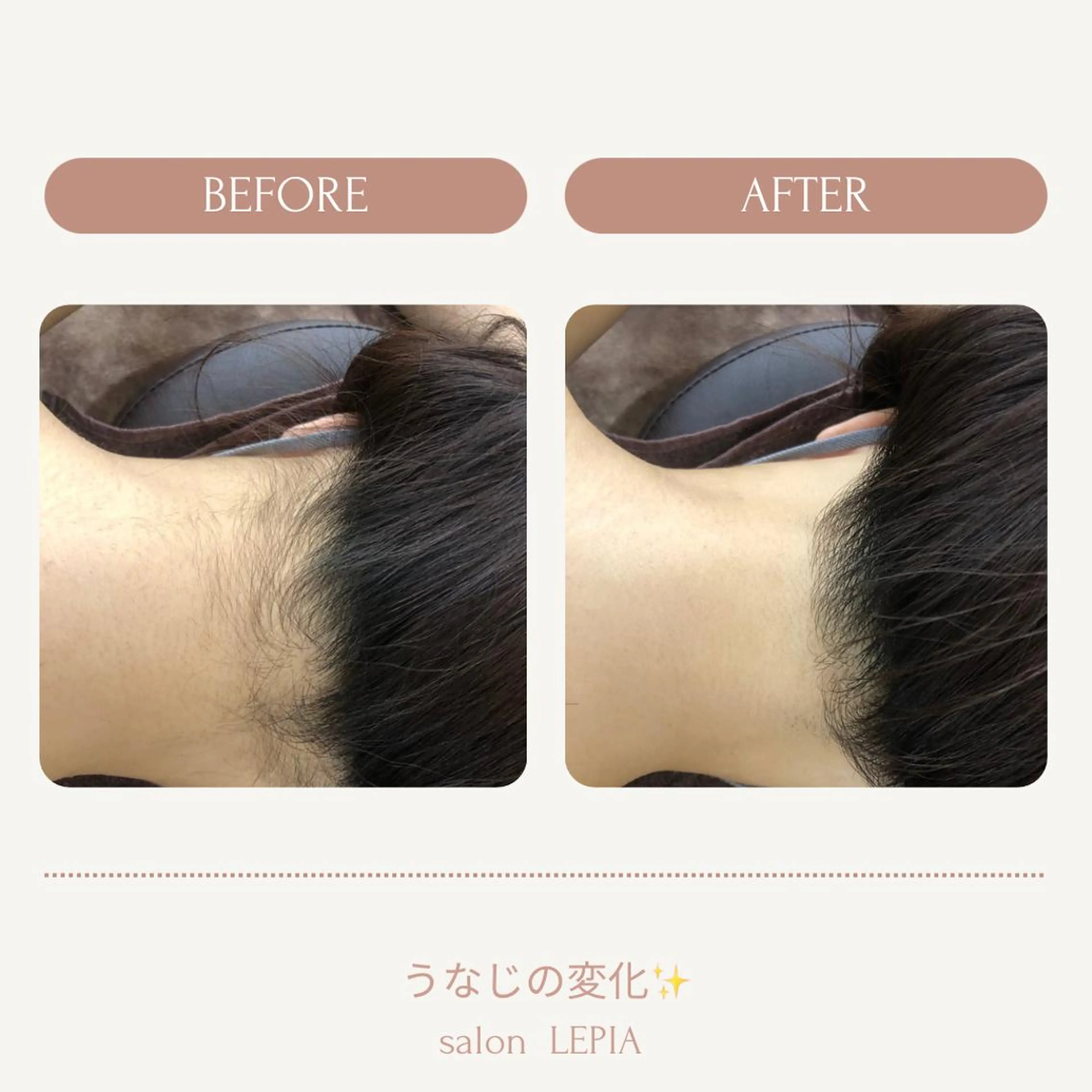 男女同額完全個室脱毛 LEPIA内田のエステ・リラクイメージ