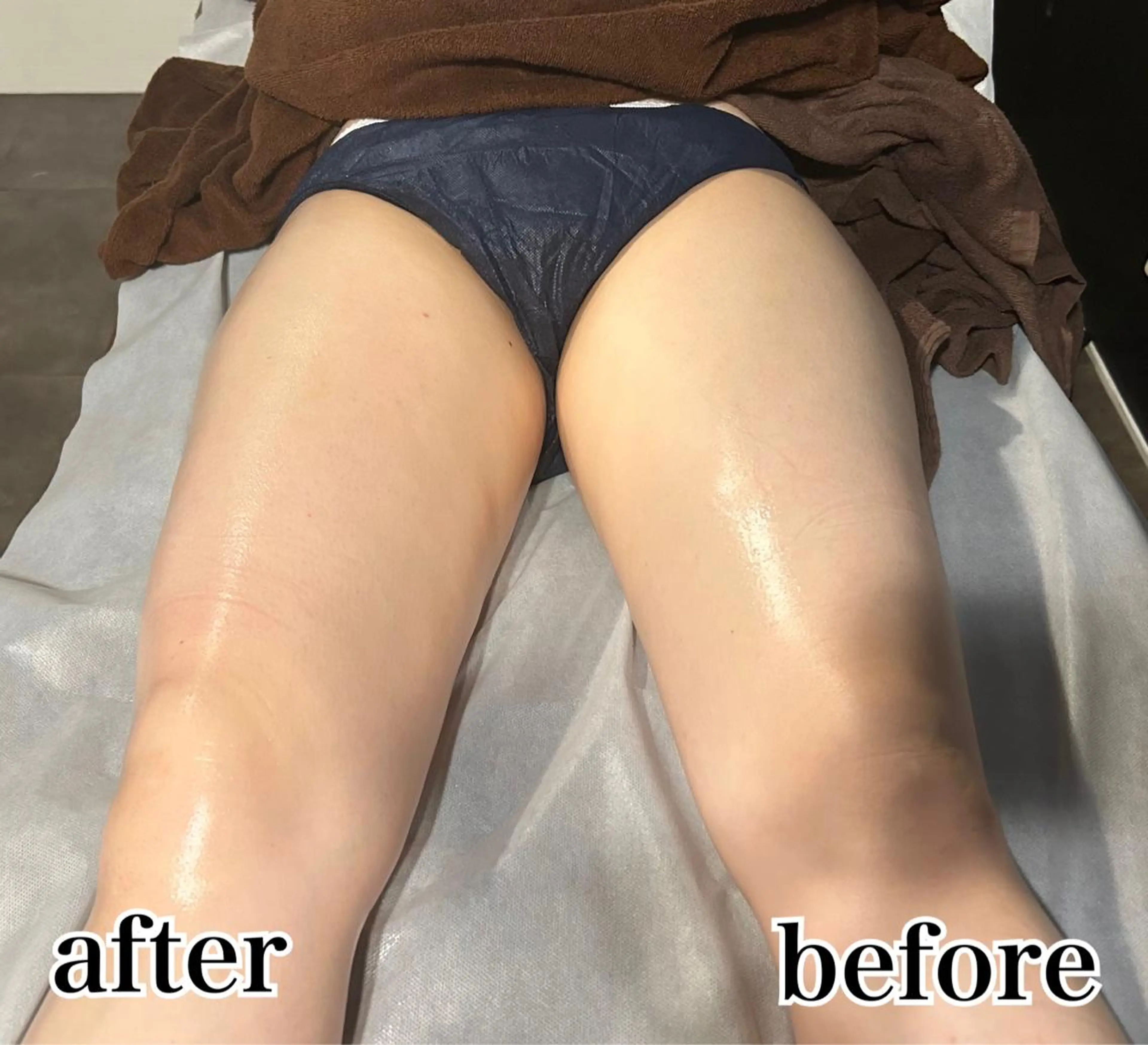 エステ Gemini MIKIのエステ・リラクイメージ