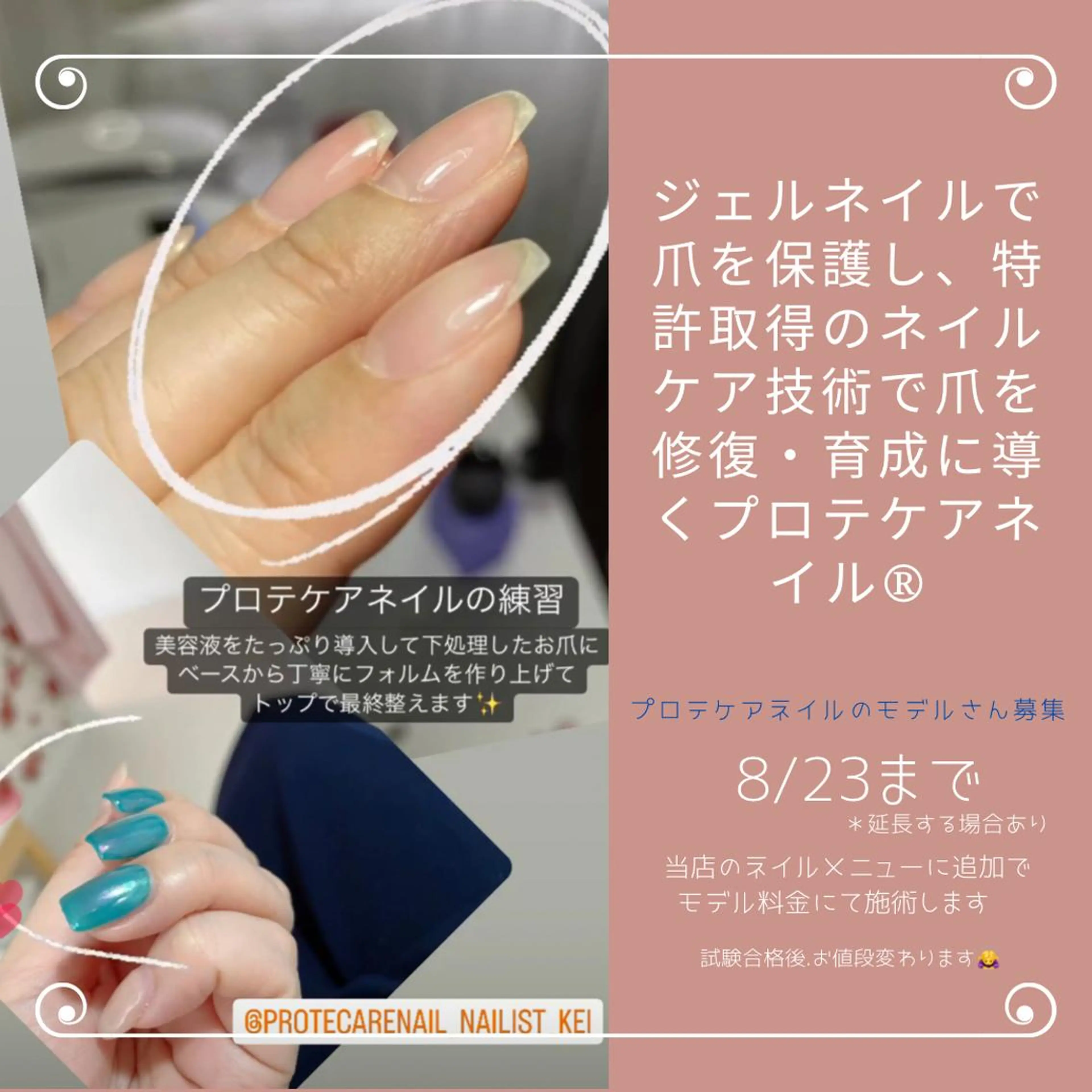 ネイル Embellir ♡鏡味のその他イメージ