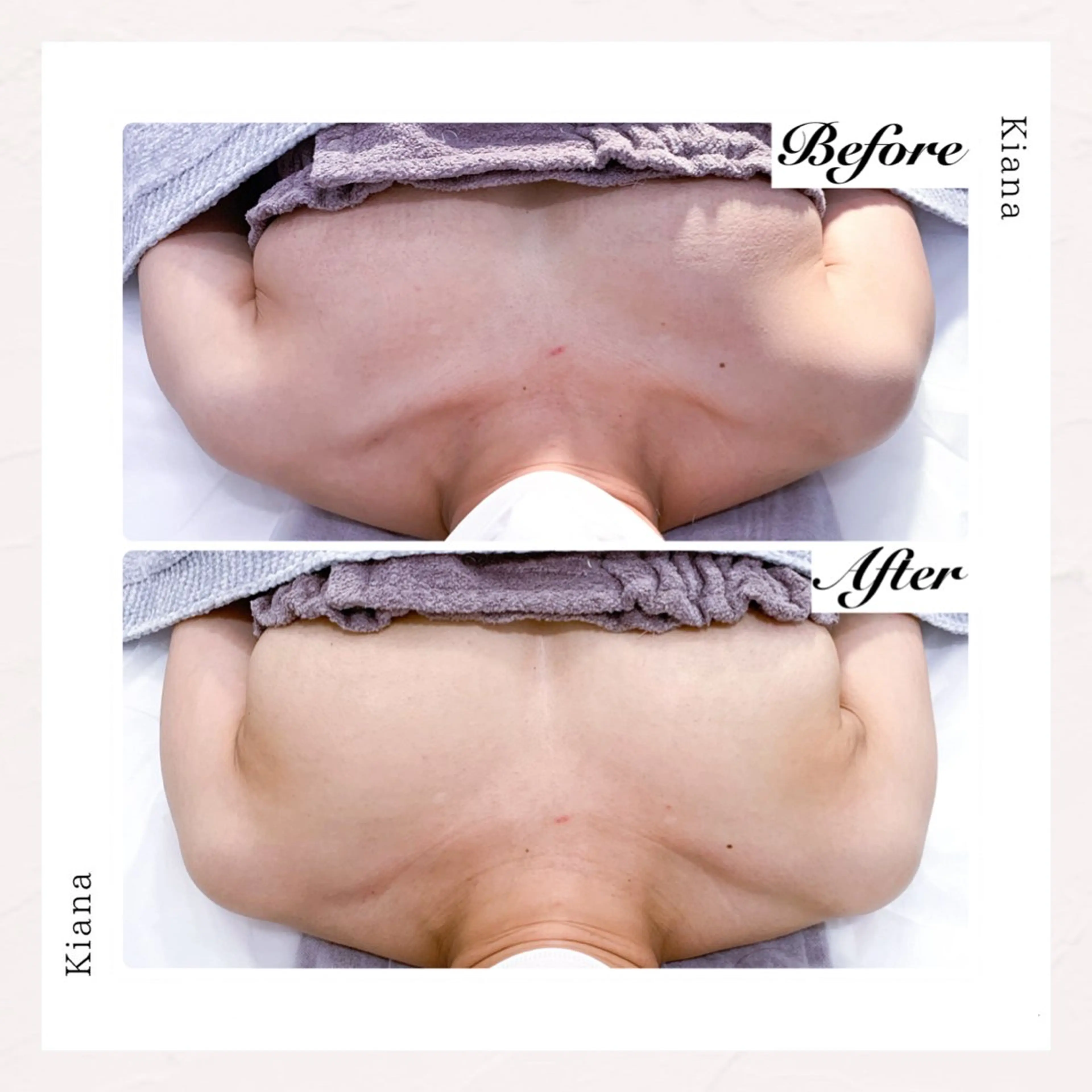 バスト専門Kiana 風のエステ・リラクイメージ