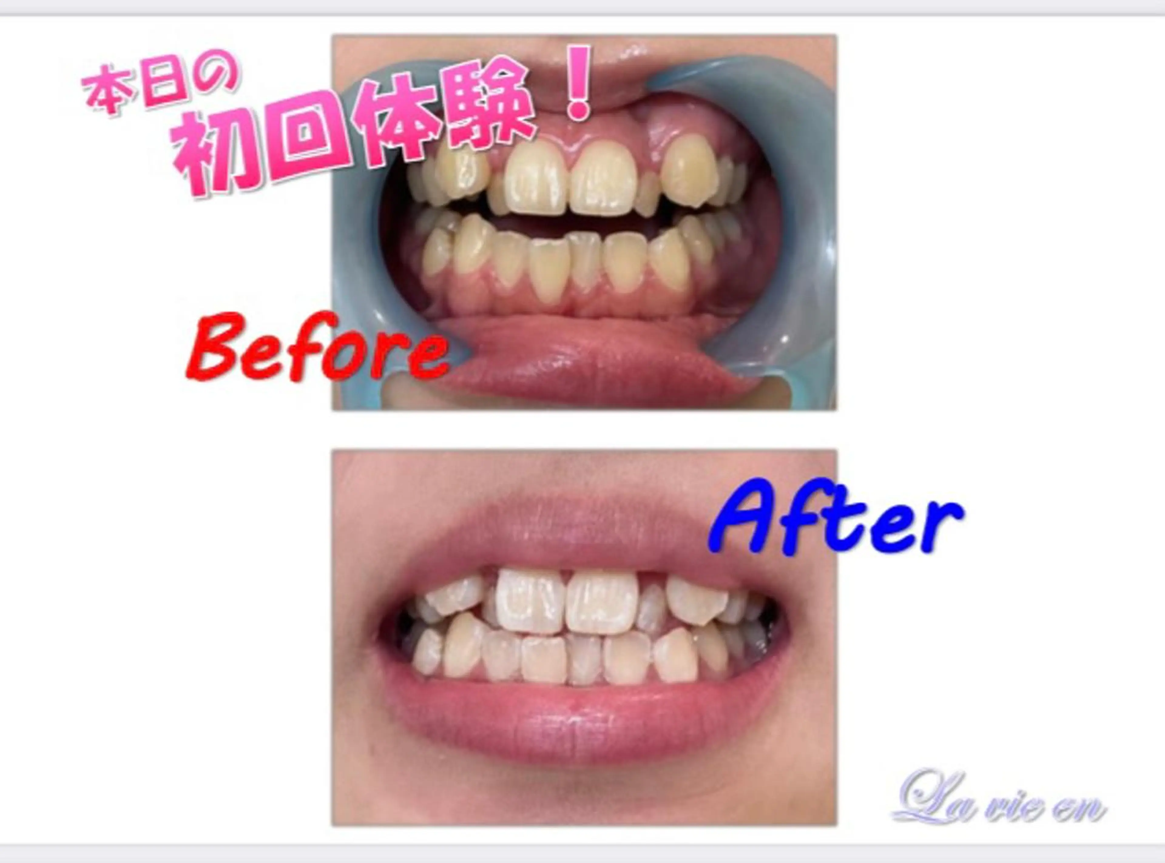 その他 セルフホワイトニングサロン　ラヴィアン所属・ホワイトニングサロン La vie enのその他イメージ