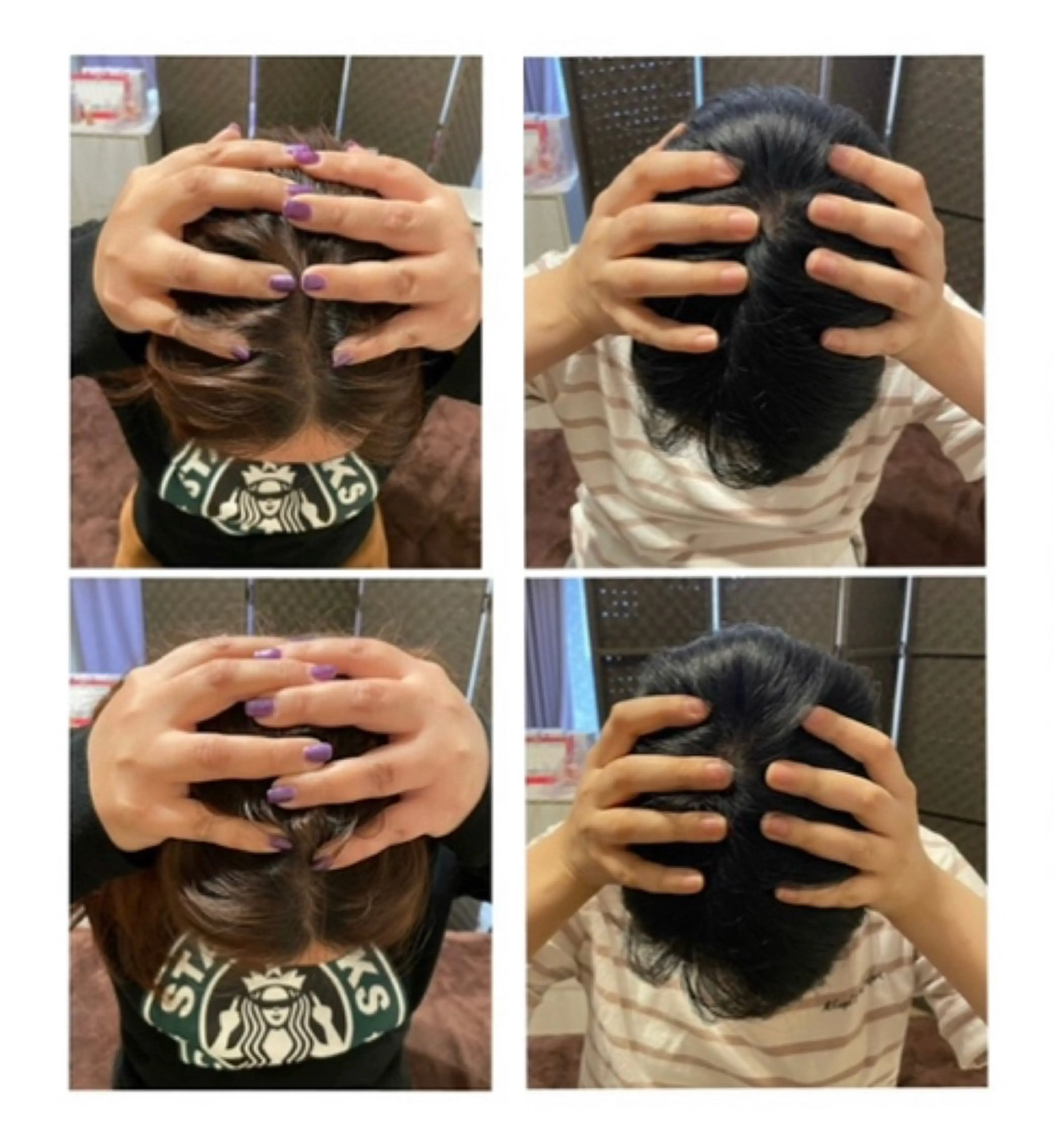 今だけ無料!看護師が行う👩⚕️自律神経を整えるヘッドスパ体験🌙 不眠/小顔/偏頭痛/肩凝り/リフトアップ効果の写真