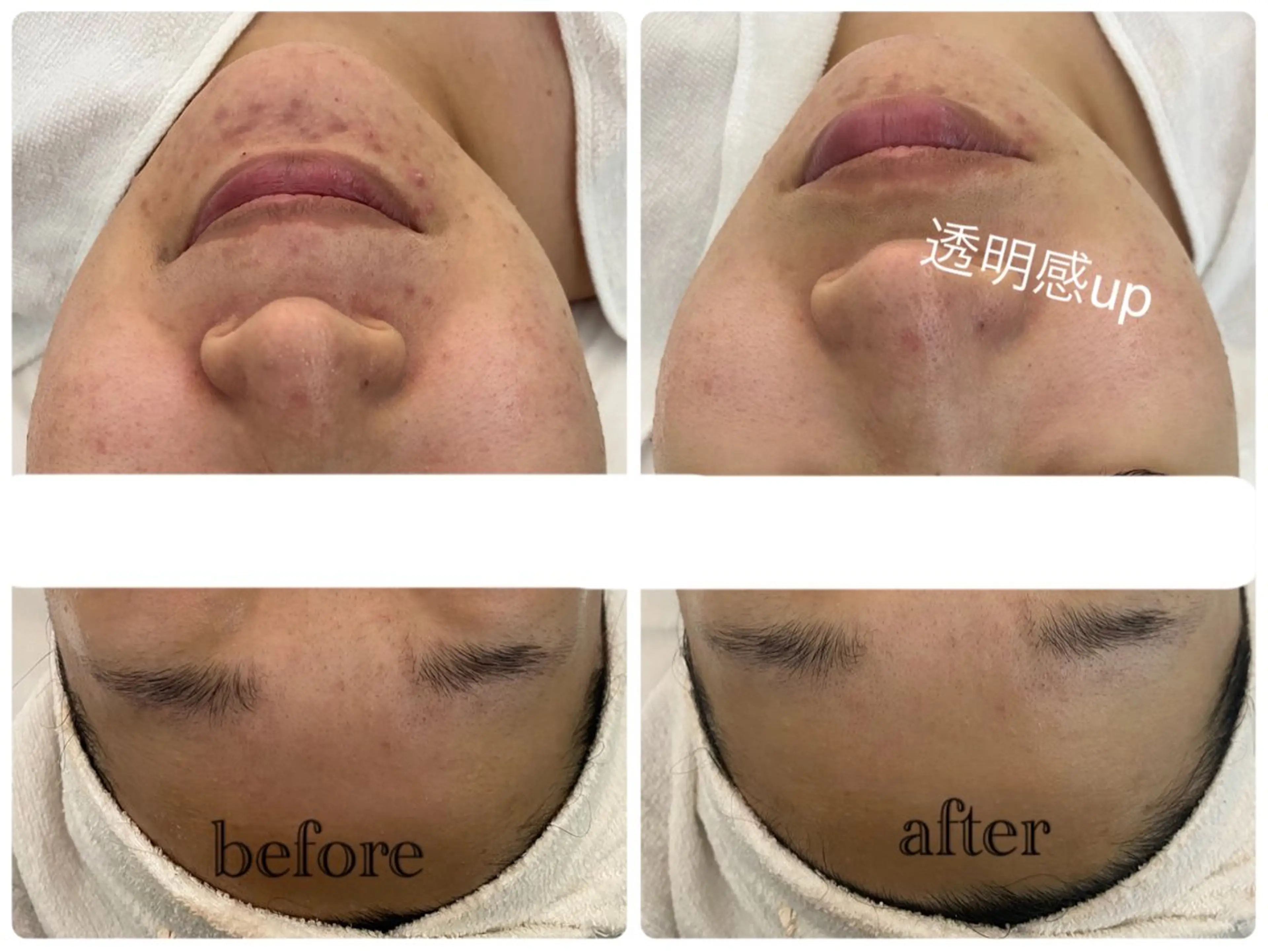 デ・アイム新潟北所属・サイトウ .のエステ・リラクイメージ