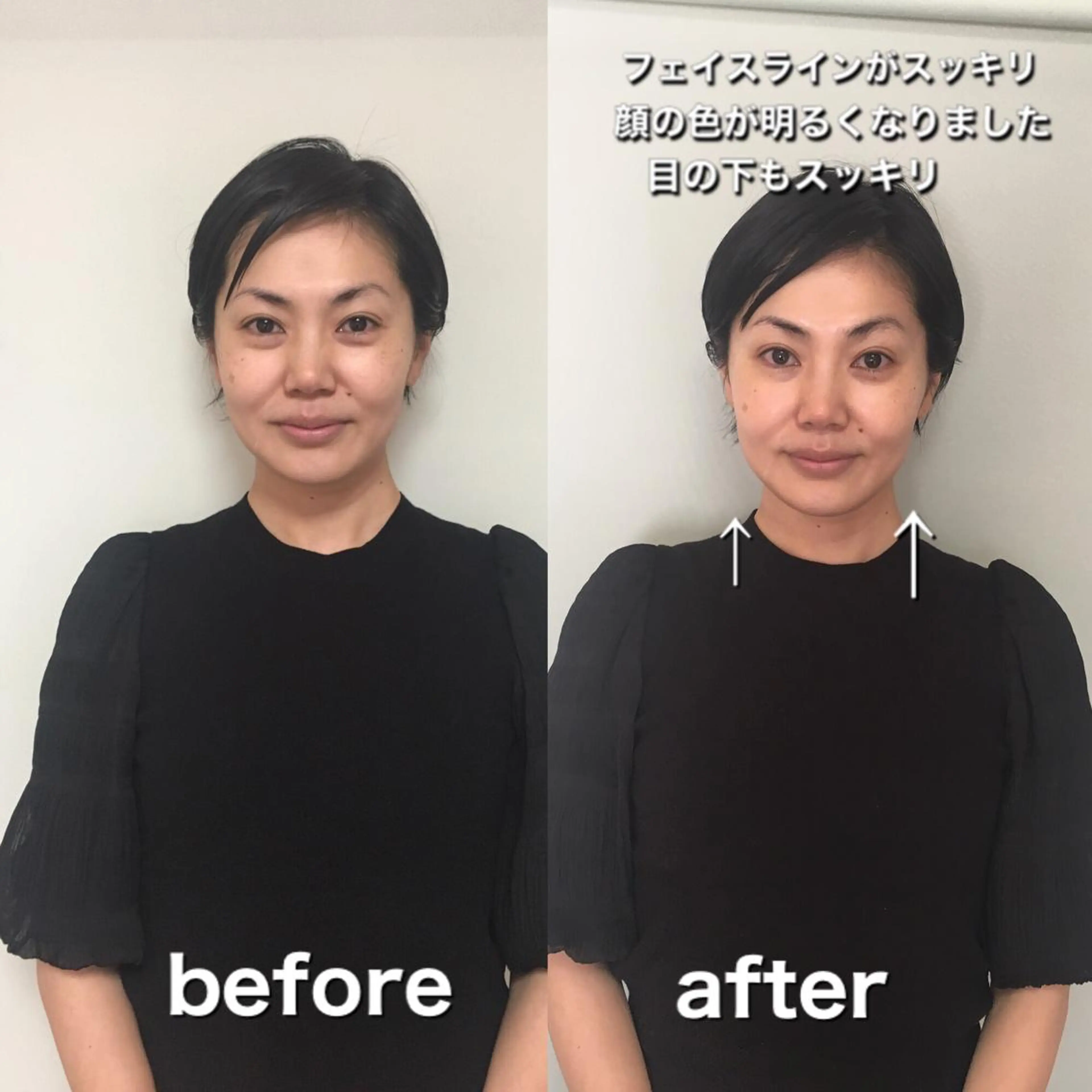 エステ 小顔エステサロン マインドール所属・泉大津エステ毛穴   シミ専門サロンのエステ・リラクイメージ