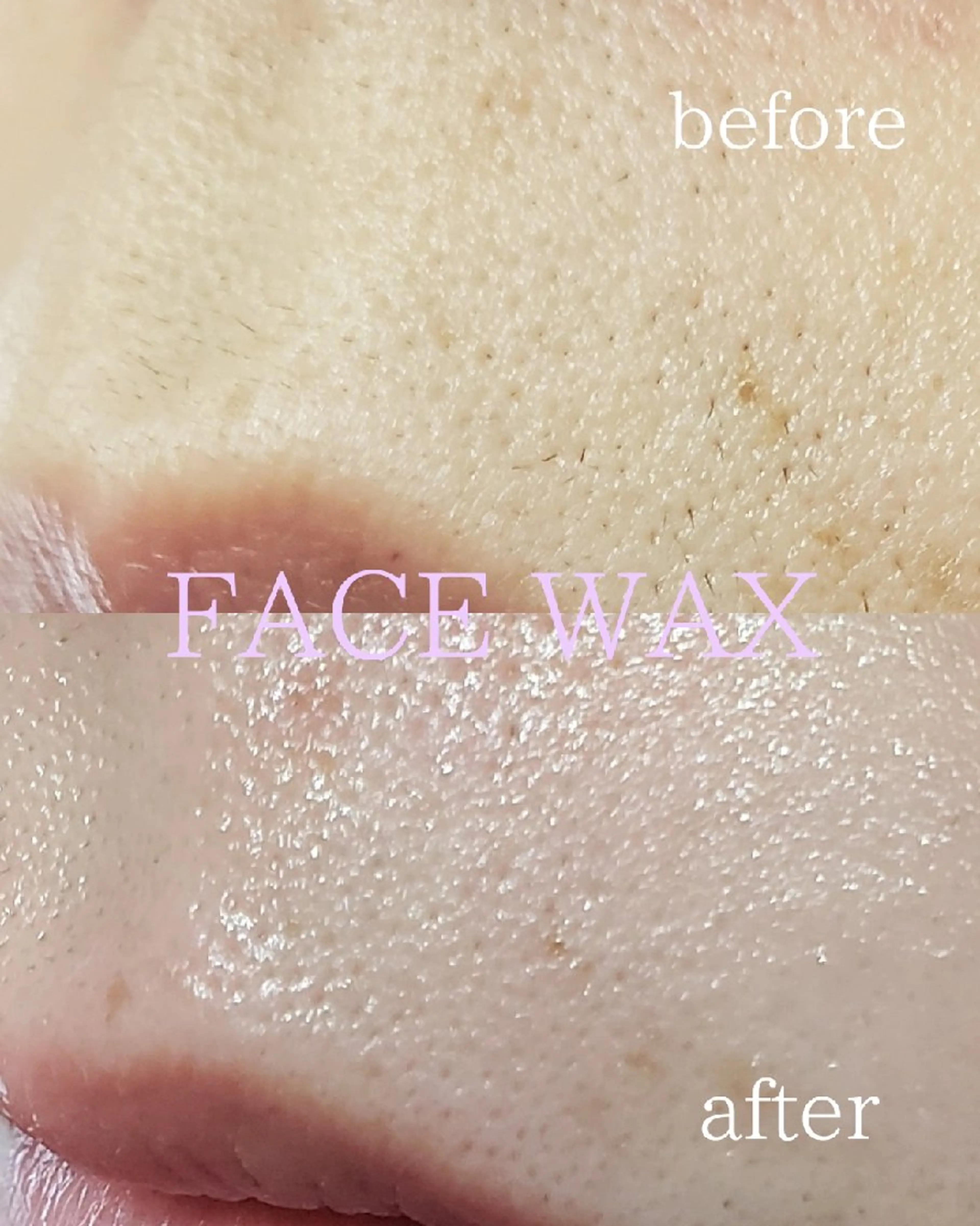 ワックス脱毛 FACE WAX chisato所属・フェイスワックス &アイブロウのエステ・リラクイメージ